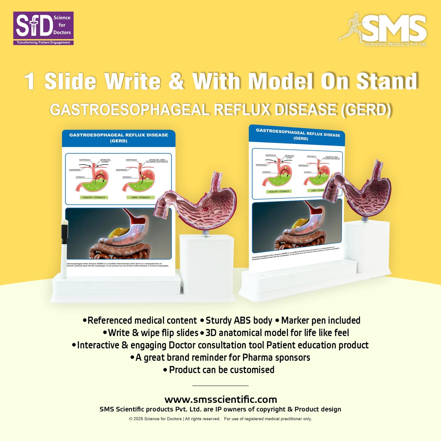 Gastroesophageal Reflux Disease: 1 Slide write and wipe with anatomical model on stand