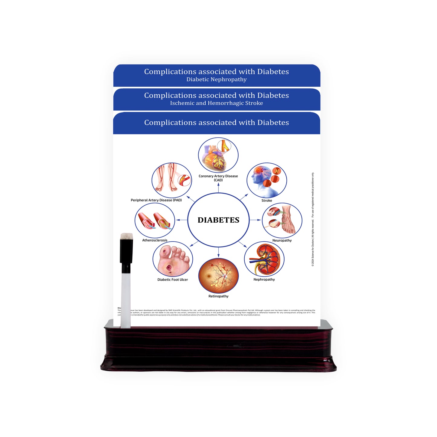 Complications With Diabetes_1: 3 Slides on Stand
