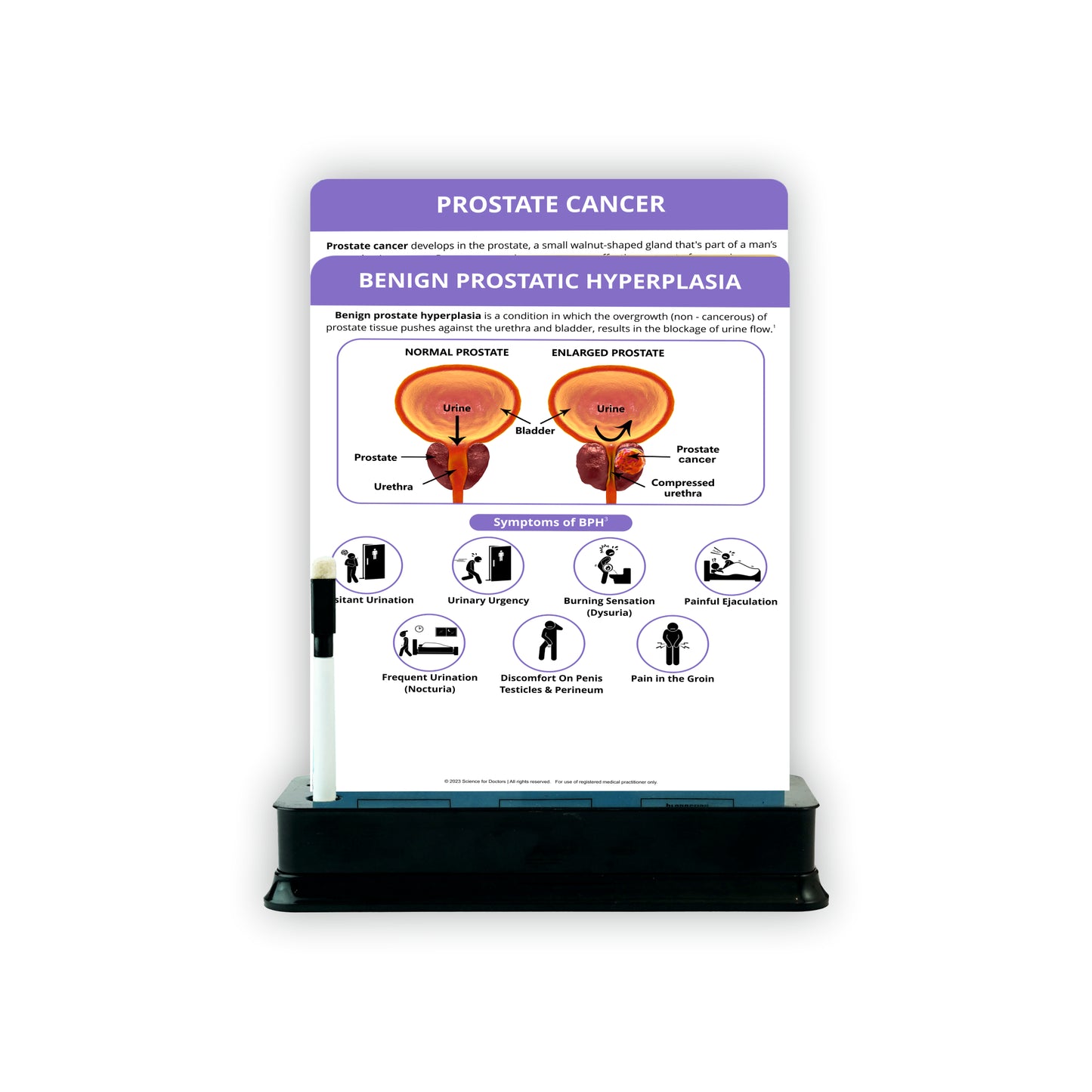 Benign Prostatic Hyperplasia_1 : 2 Slides With Stand