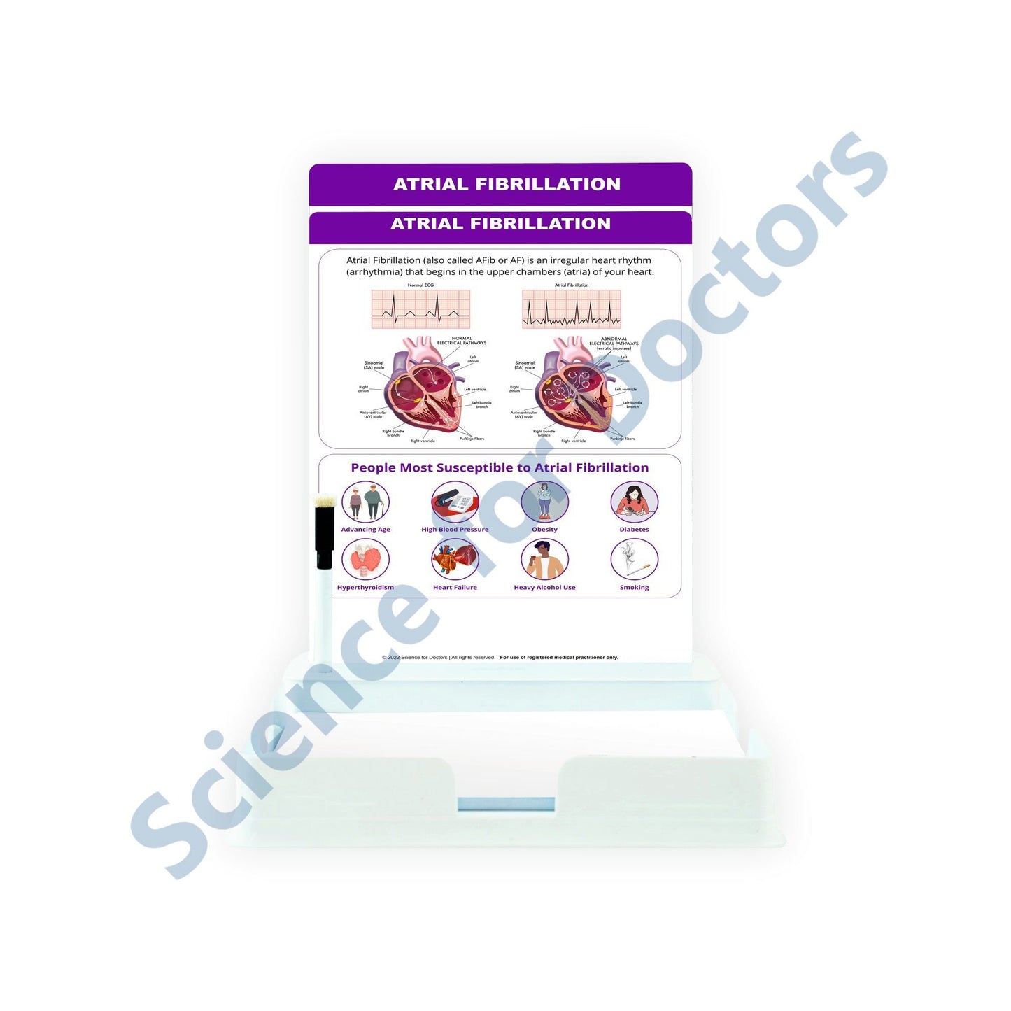 ATRIAL FIBRILLATION: 2 Slides Patient Leaflet Tray