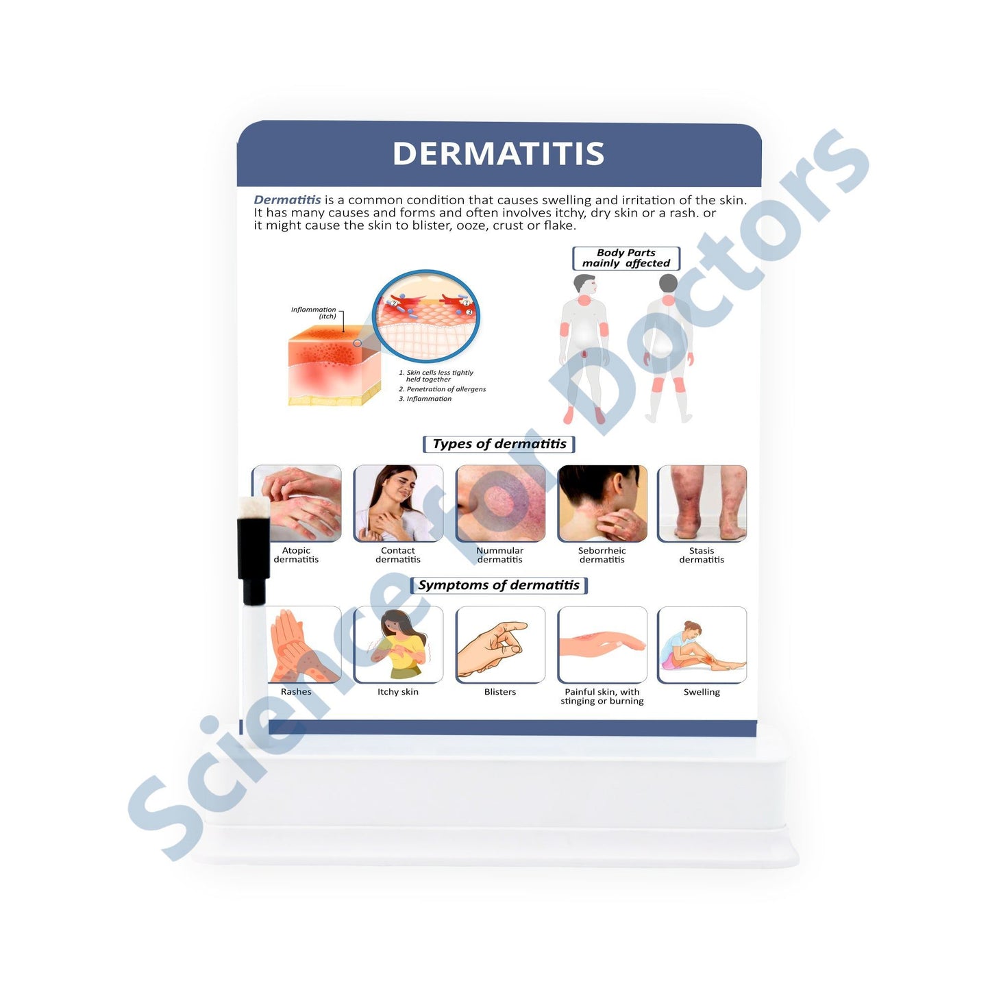 Dermatitis: 1 Slide On Stand