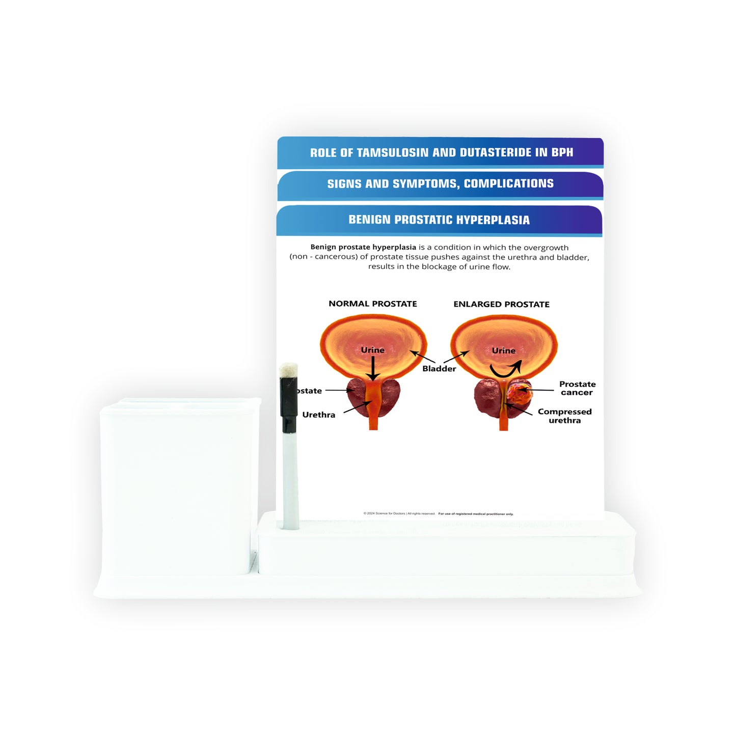 Benign Prostatic Hyperplasia_1: 3 Slides Write & Wipe with Stationary Stand