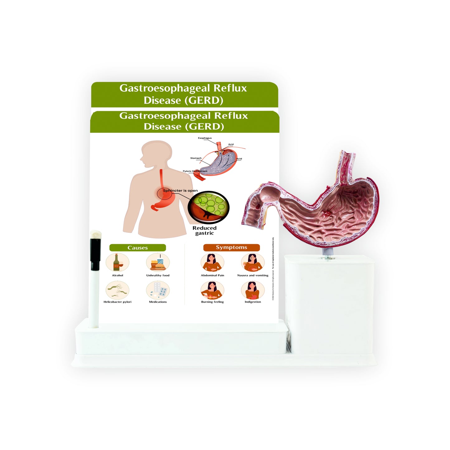 Gastroesophageal Reflux Disease: 2 Slides Write and Wipe with Model On Stand