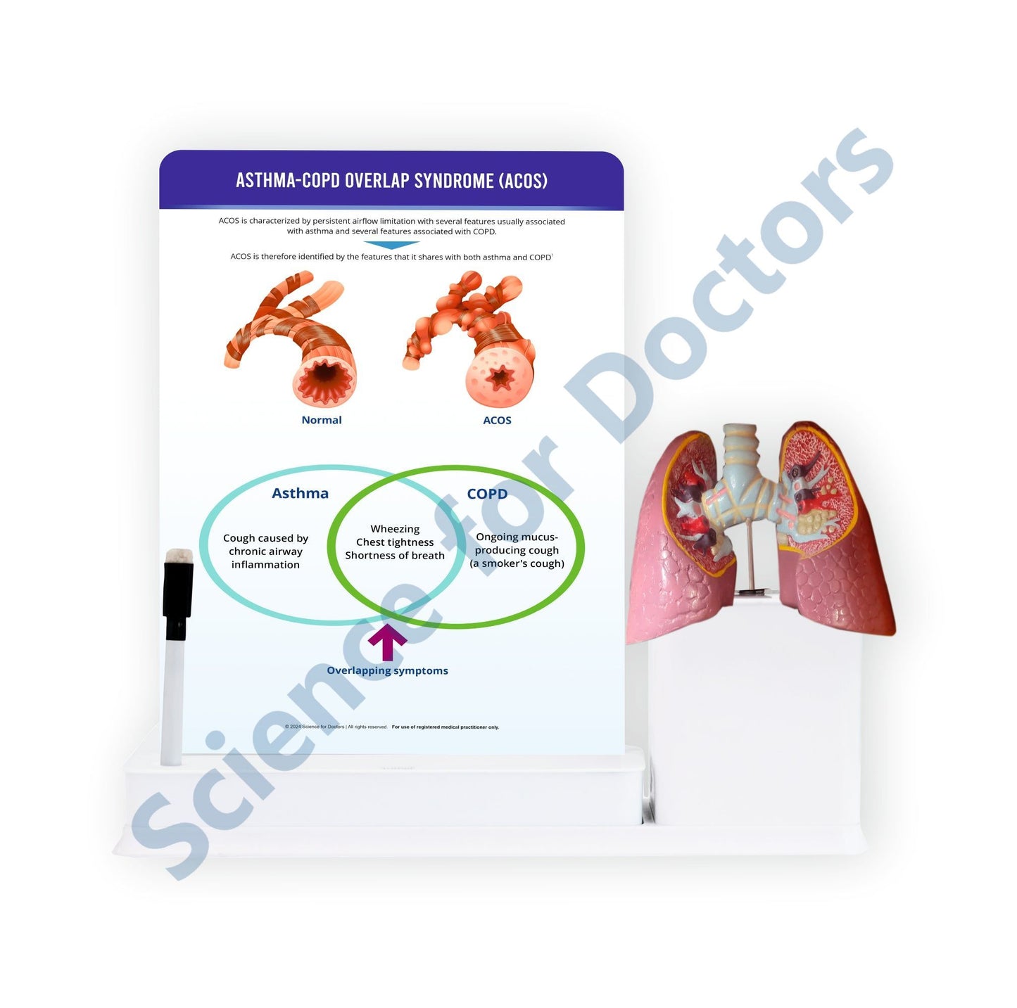 Asthma-COPD Overlap Syndrome (ACOS): 1 Slide write and wipe with anatomical model on stand