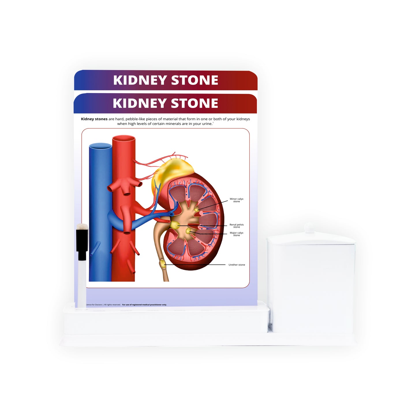 Kidney Stone: 2 Slide Write Wipe With Utility Container