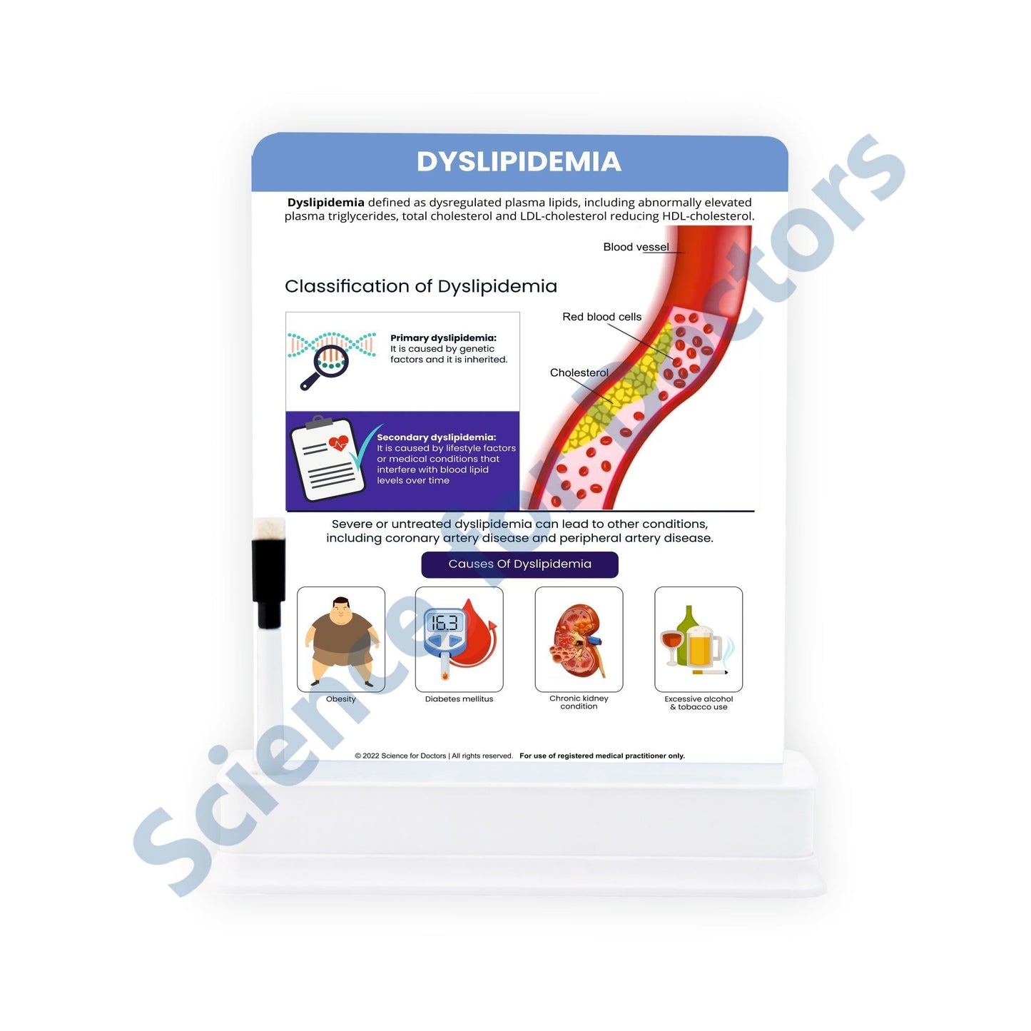 Dyslipidemia: 1 Slide With Stand