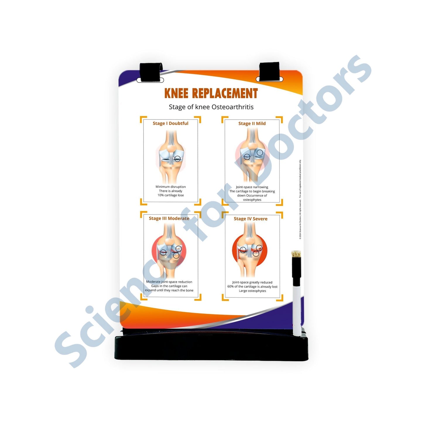 Knee Replacement: A4 Flip Wipe