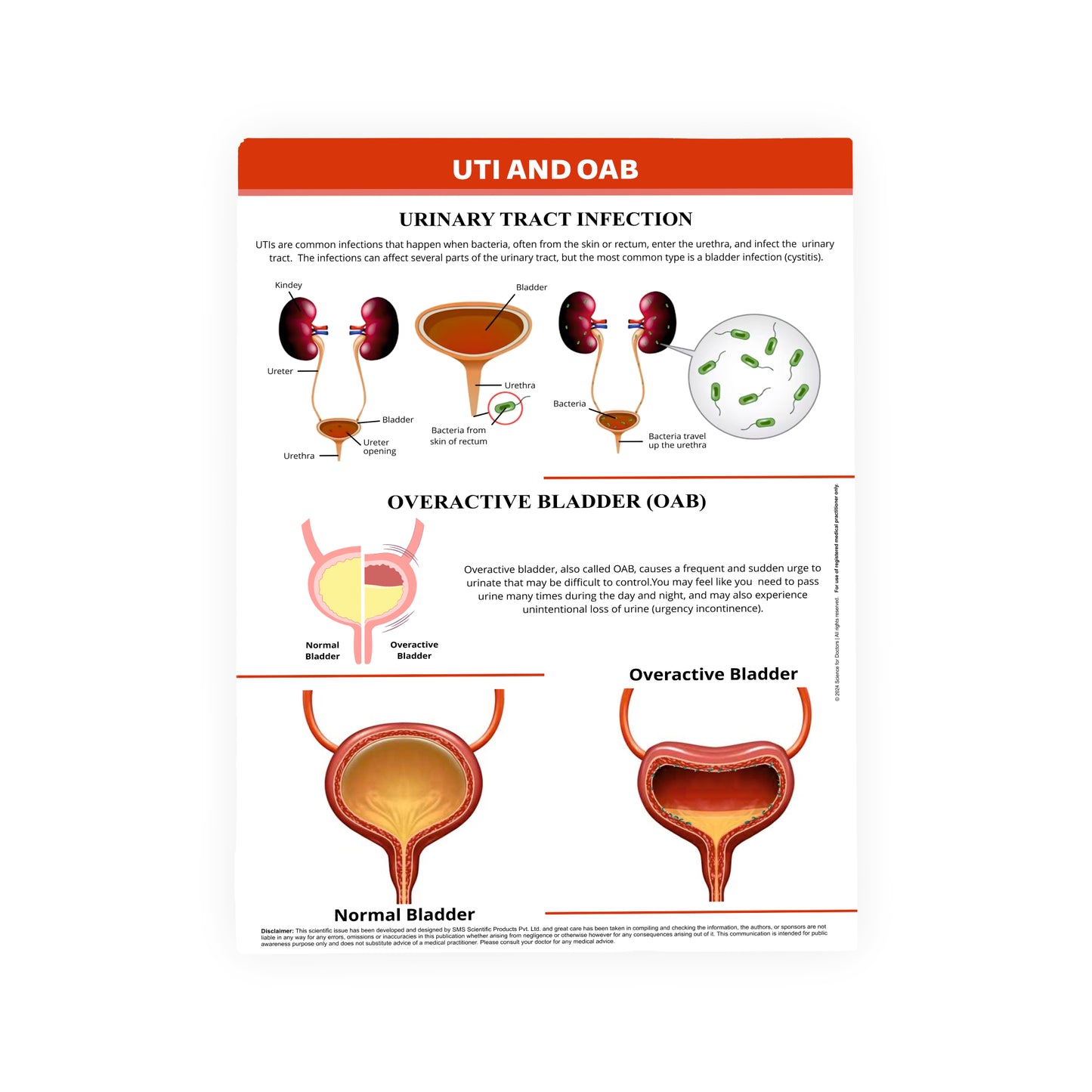 UTI AND OAB: Therapy Board