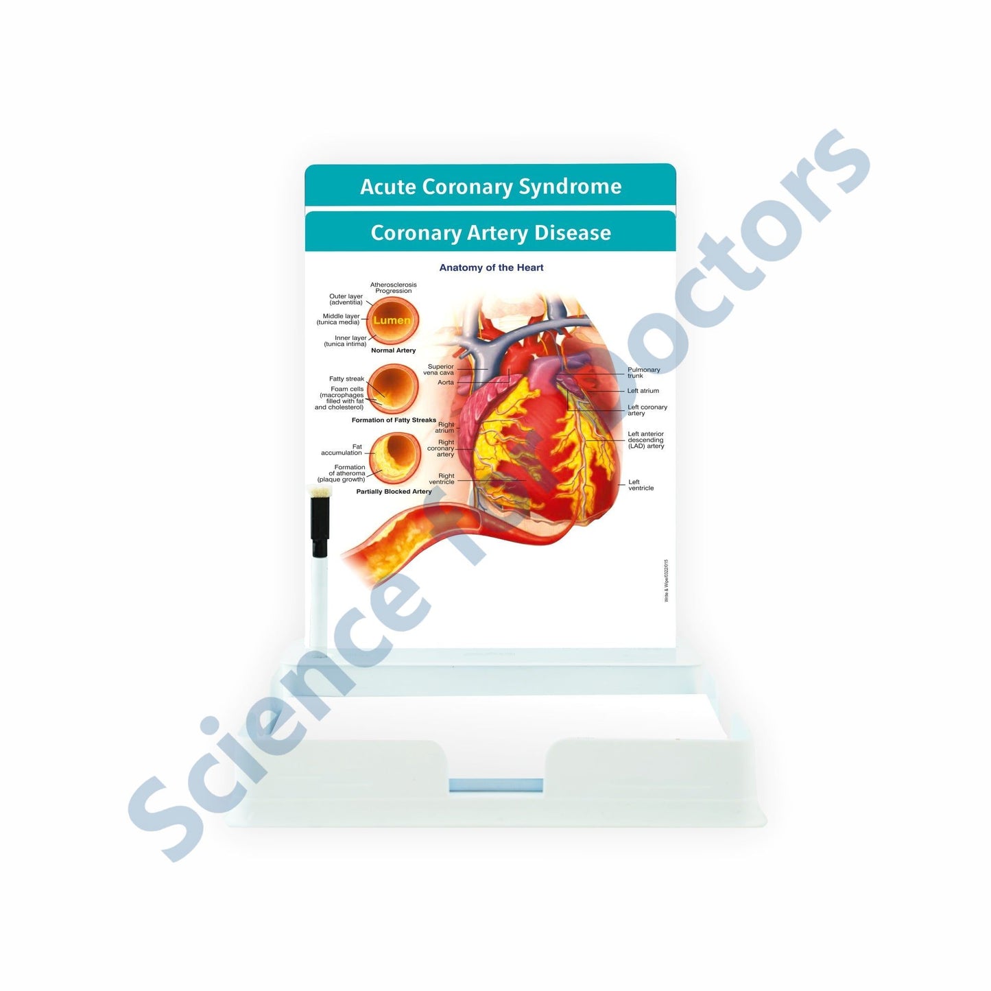 Coronary Artery Disease: 2 Slides Patient Leaflet Tray