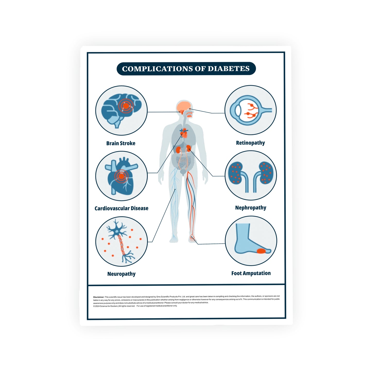 Complications of Diabetes: Therapy Board