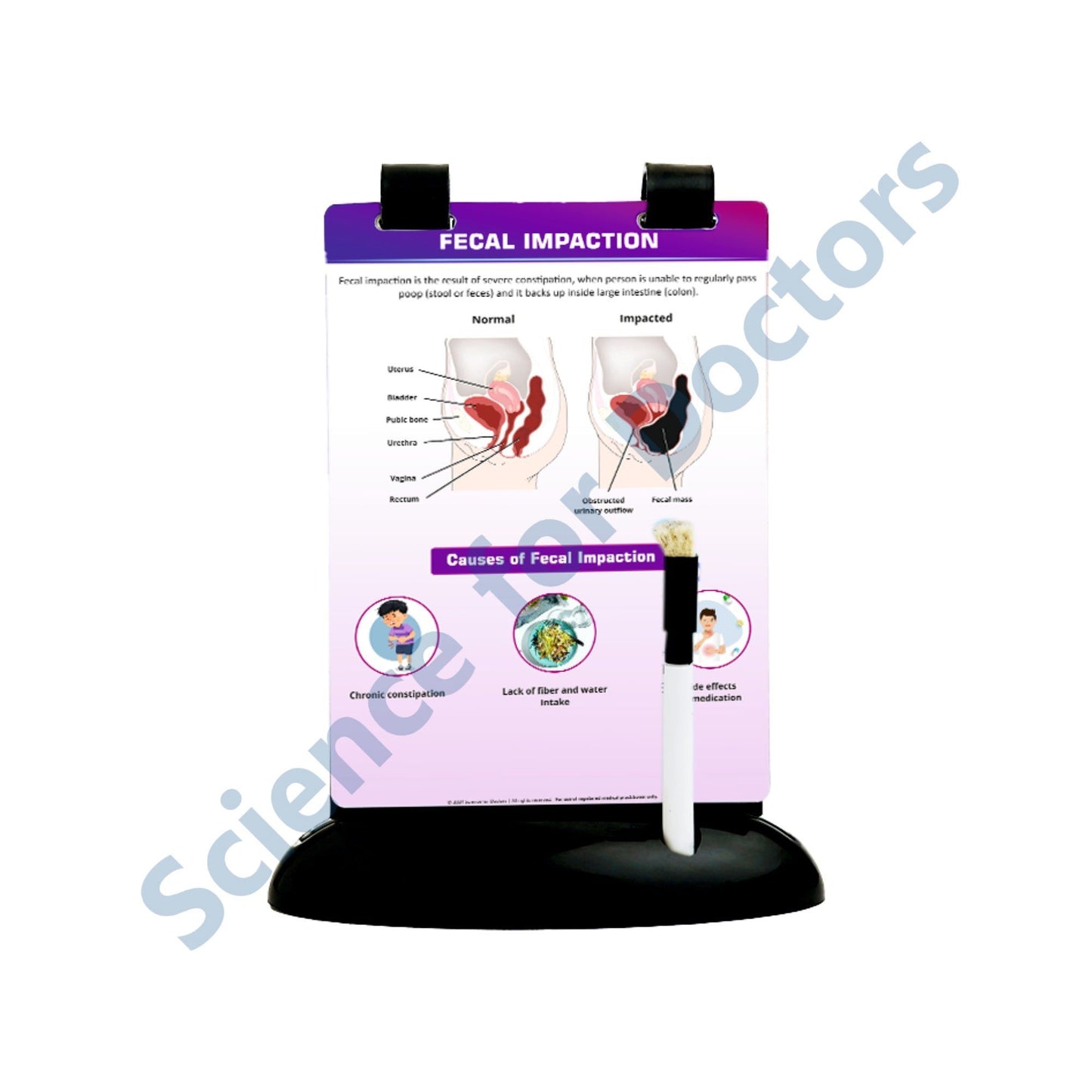Fecal Impaction: A5 Flip Wipe