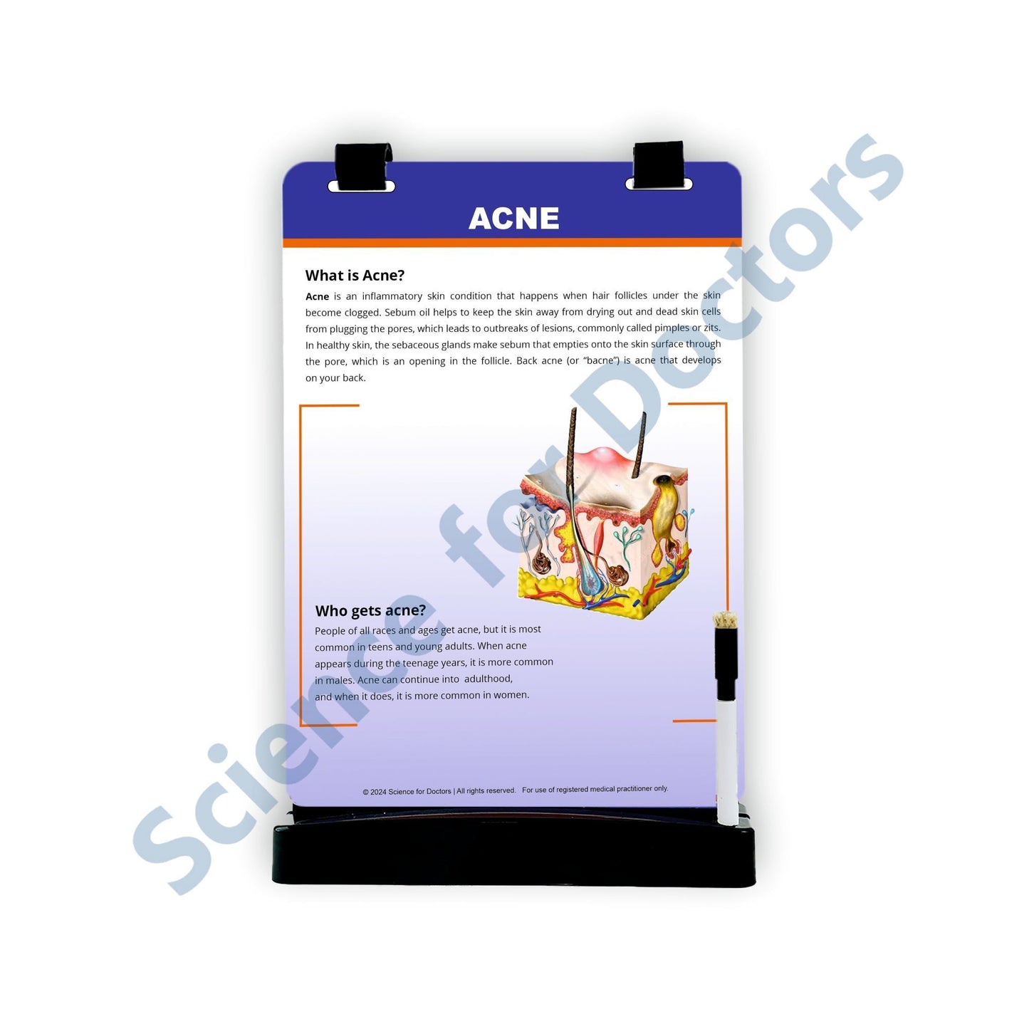 Acne_3: A4 Flip Wipe