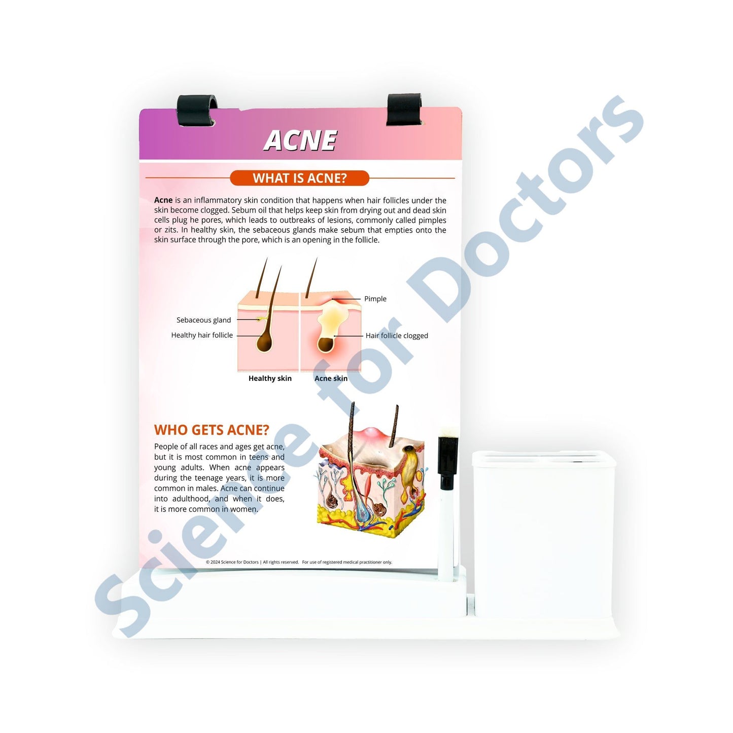 ACNE_1: A4 Flip Wipe With Stationary Stand