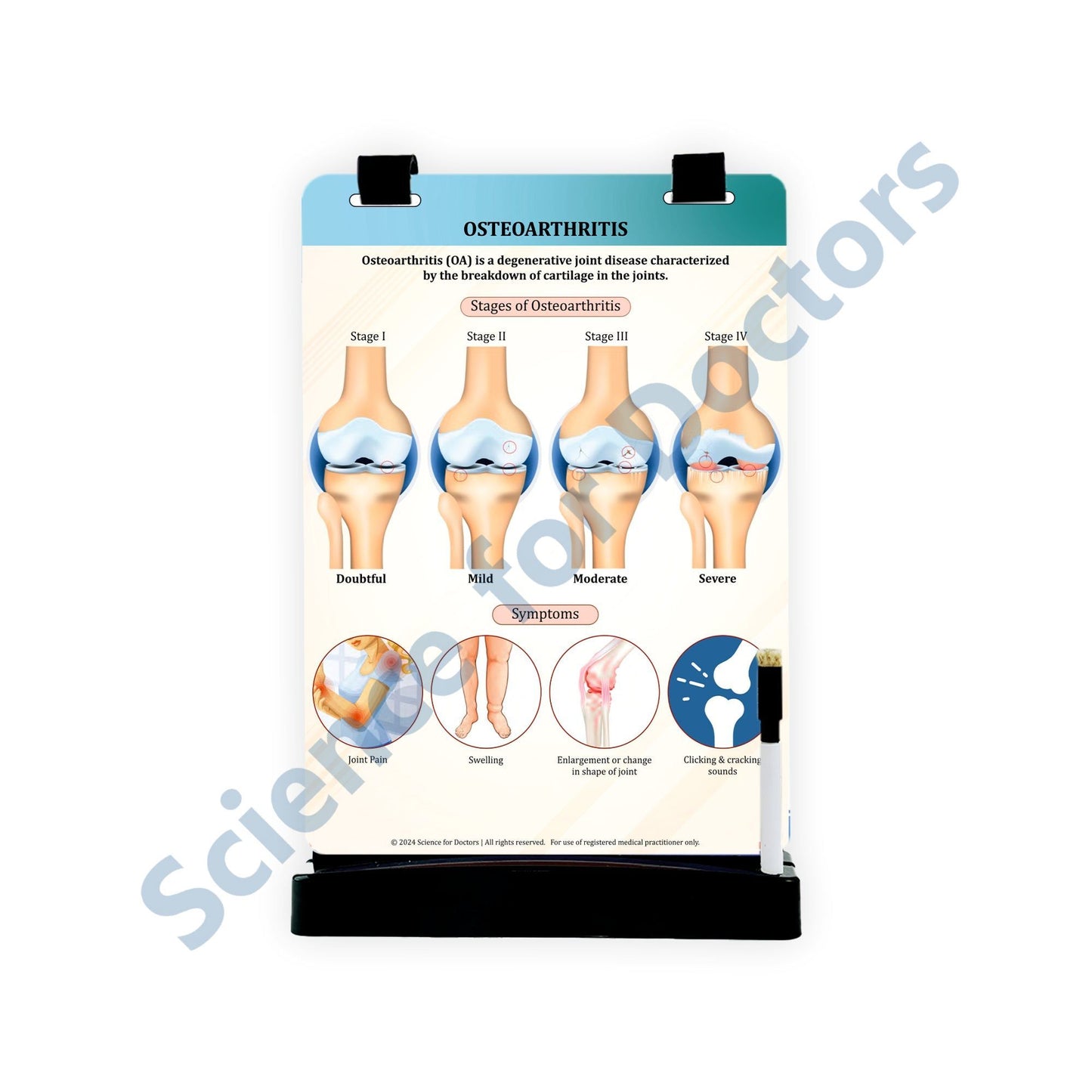 OSTEOARTHRITIS: A4 Flip Wipe