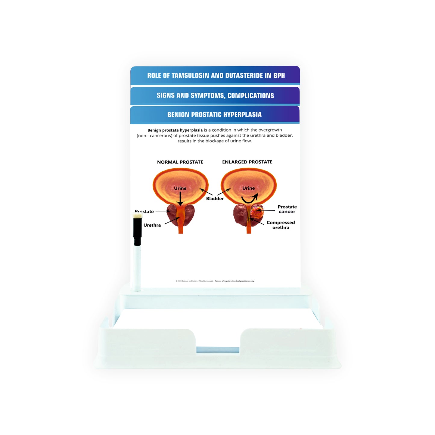 Benign Prostatic Hyperplasia : 3 Slides With Tray