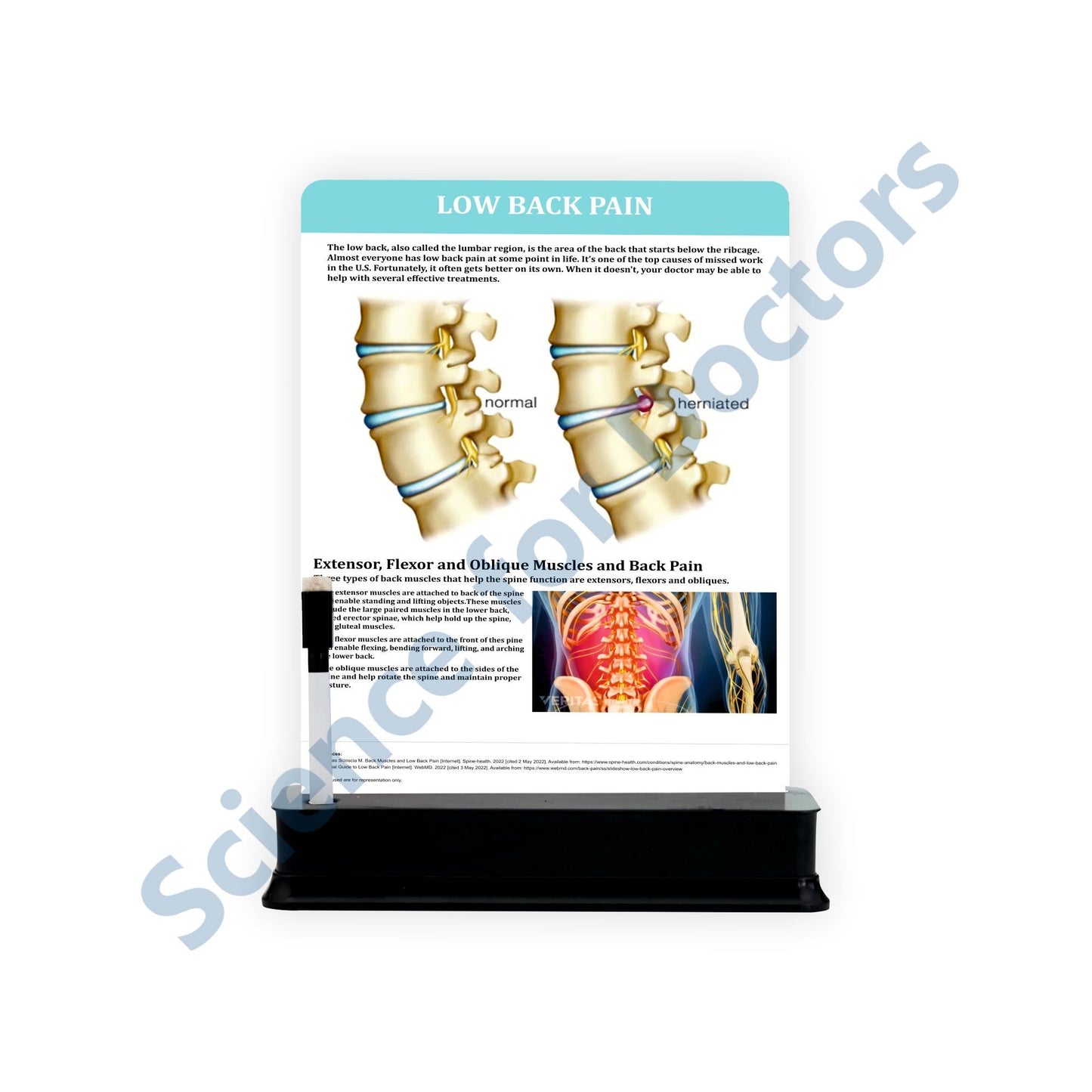 Low Back Pain: 1 Slide on stand