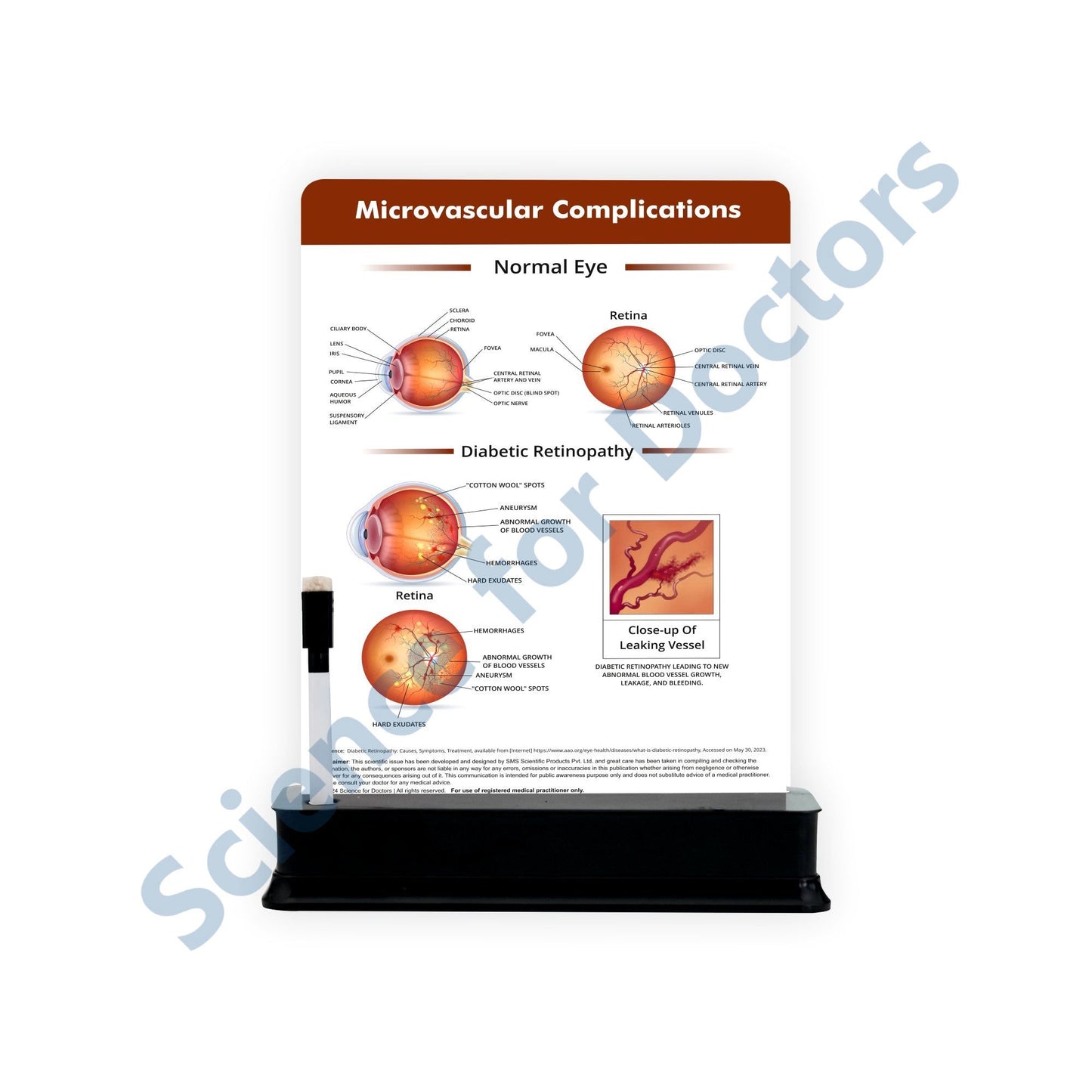 Microvascular Complications: 1 Slide on stand