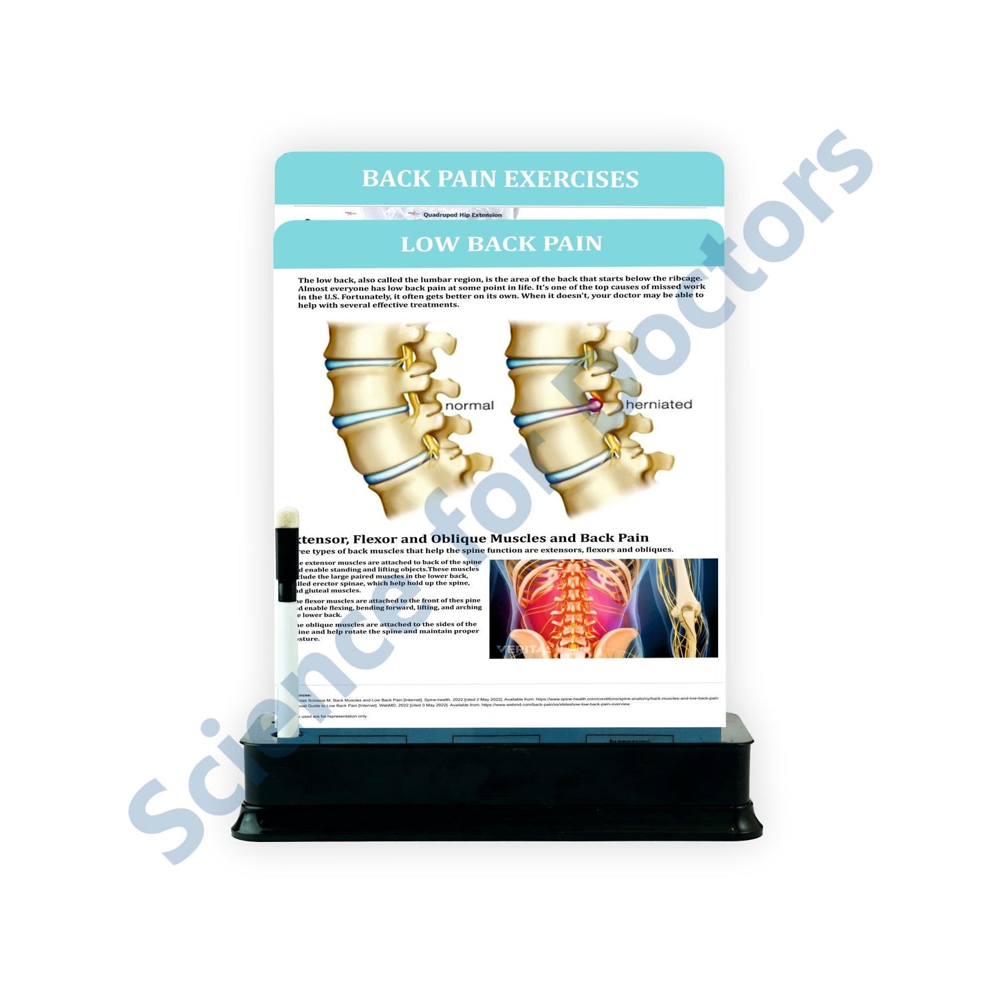 Low Back Pain: 2 Slides on stand
