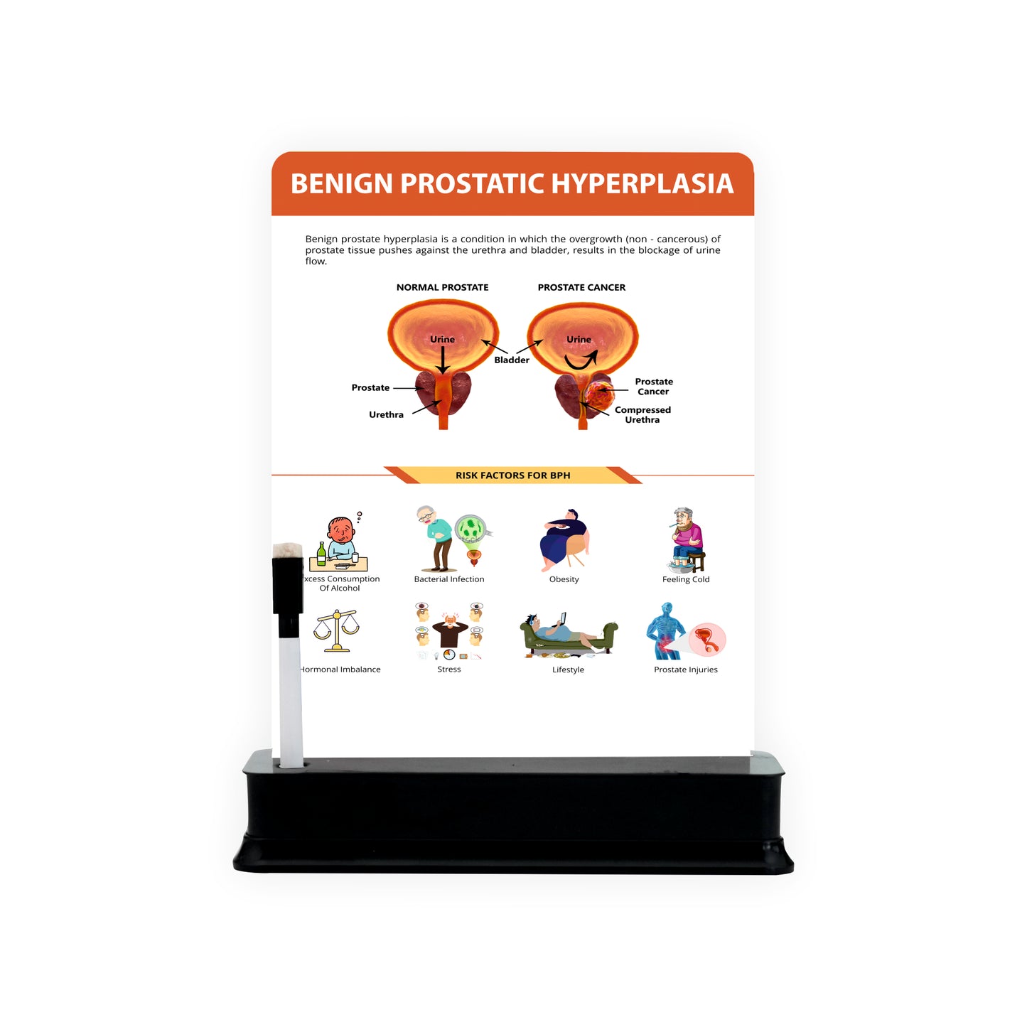Benign Prostatic Hyperplasia : 1 Slide With Stand