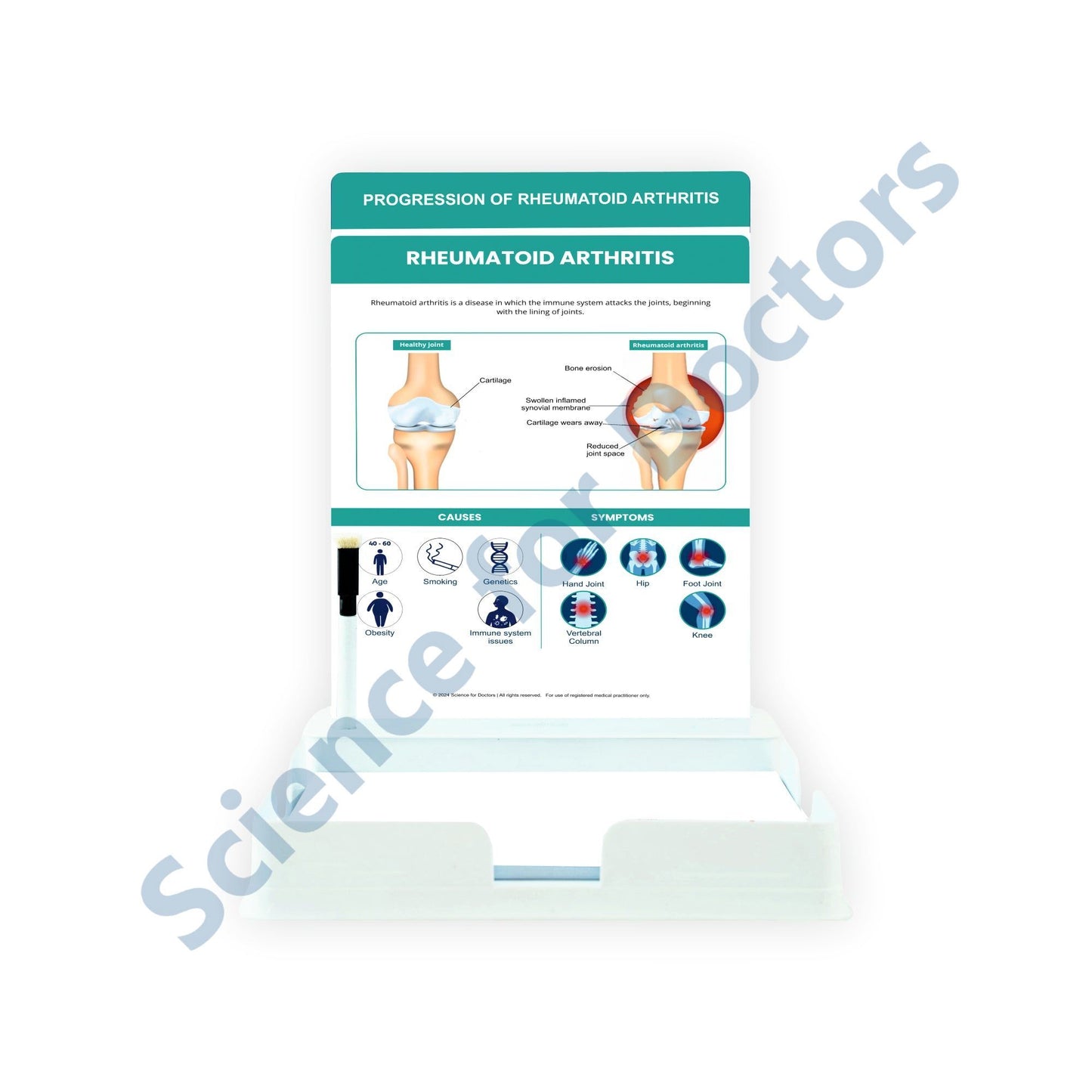 Rheumatoid Arthritis: 2 Slides Patient Leaflet Tray