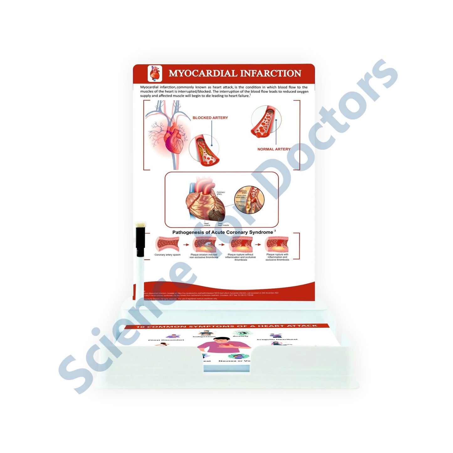 Myocardial Infarction_1: One slide with Tray