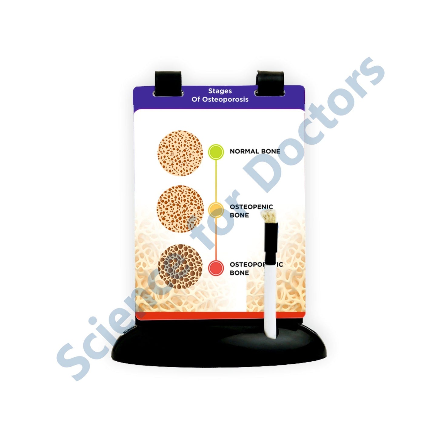 Stages of Osteoporosis: A5 Flip Wipe
