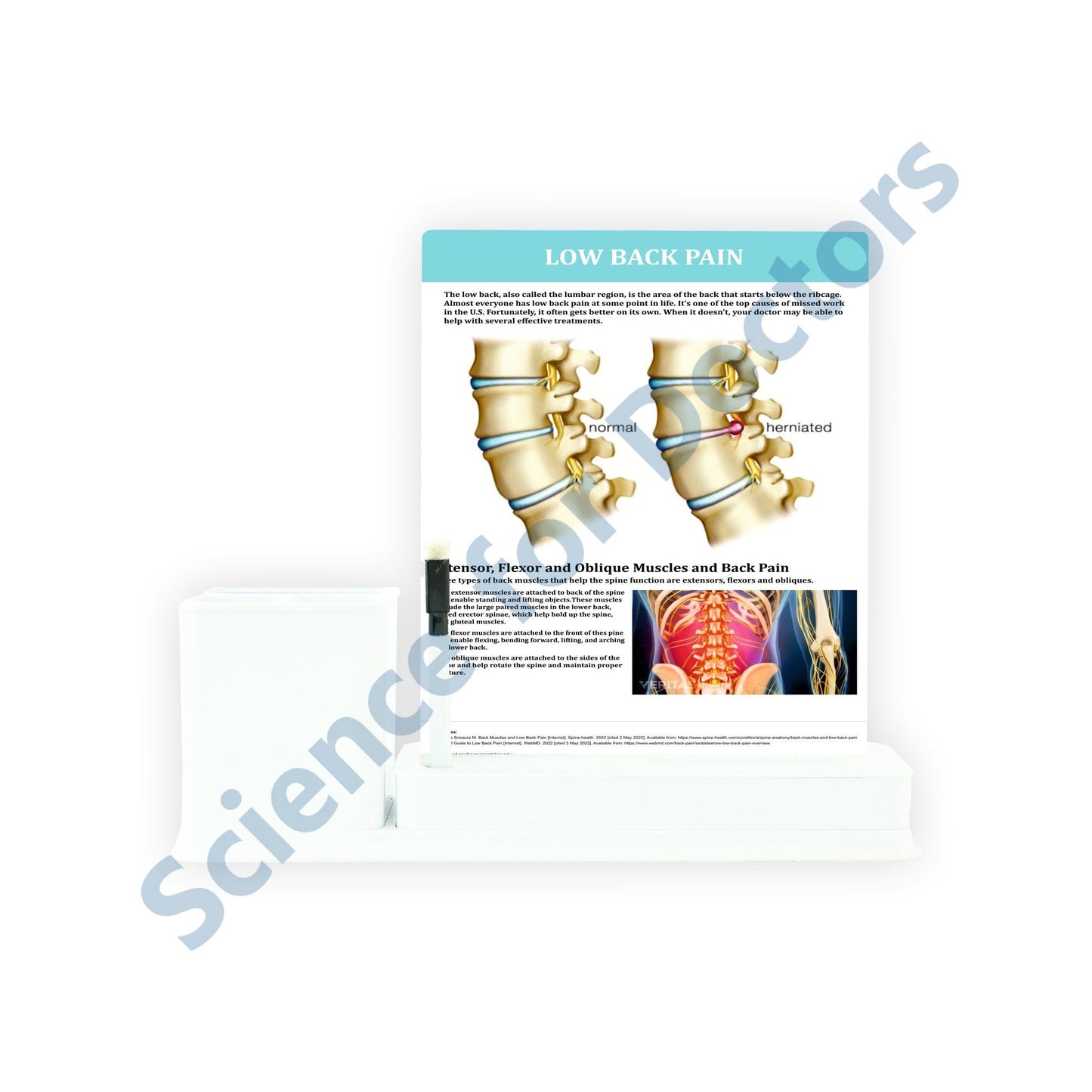 Low Back Pain: 1 Slides Write & Wipe with Stationary Stand