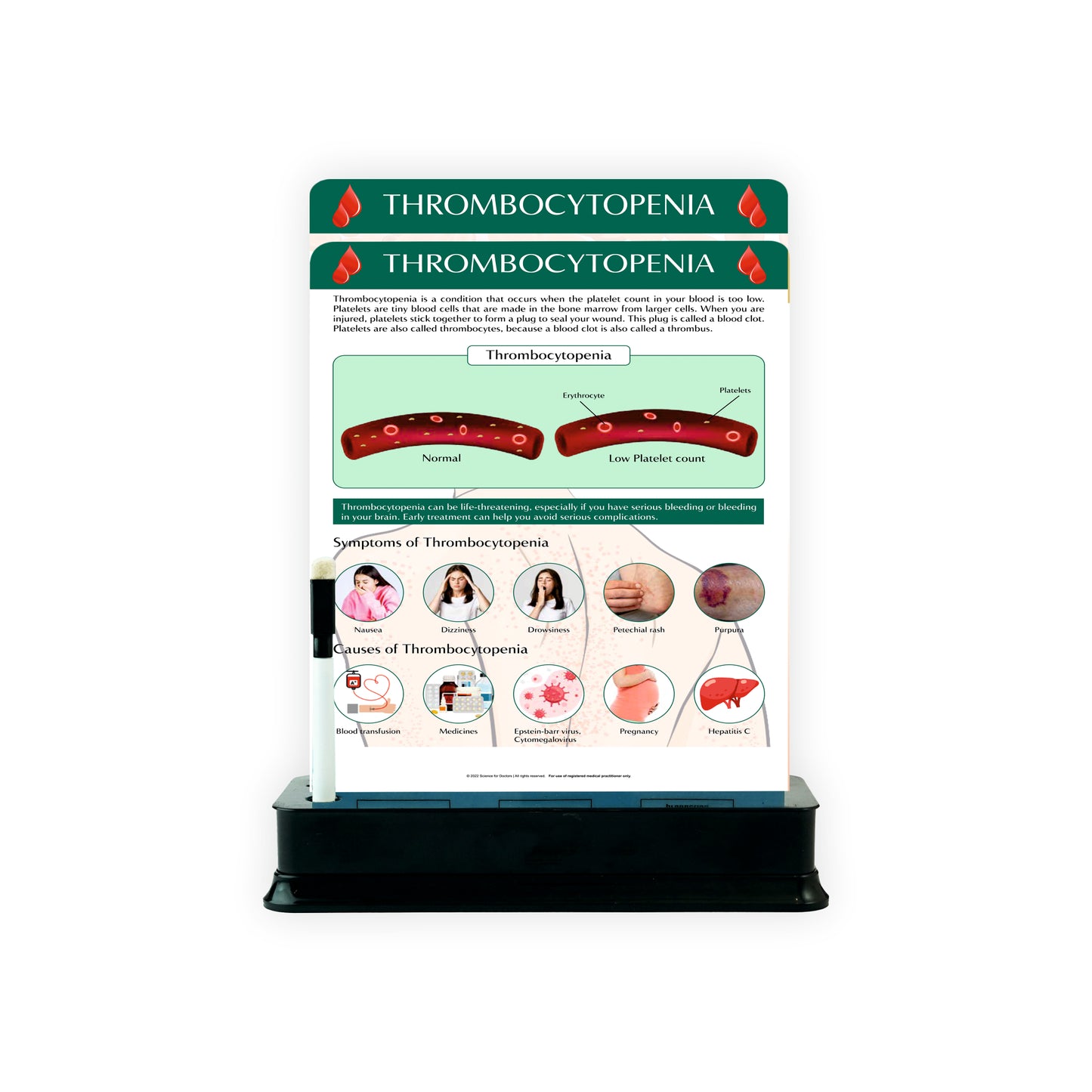 Thrombocytopenia: 2 Slides With Stand