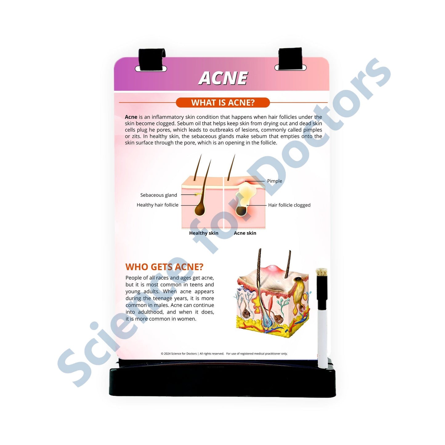 Acne_2: A4 Flip Wipe