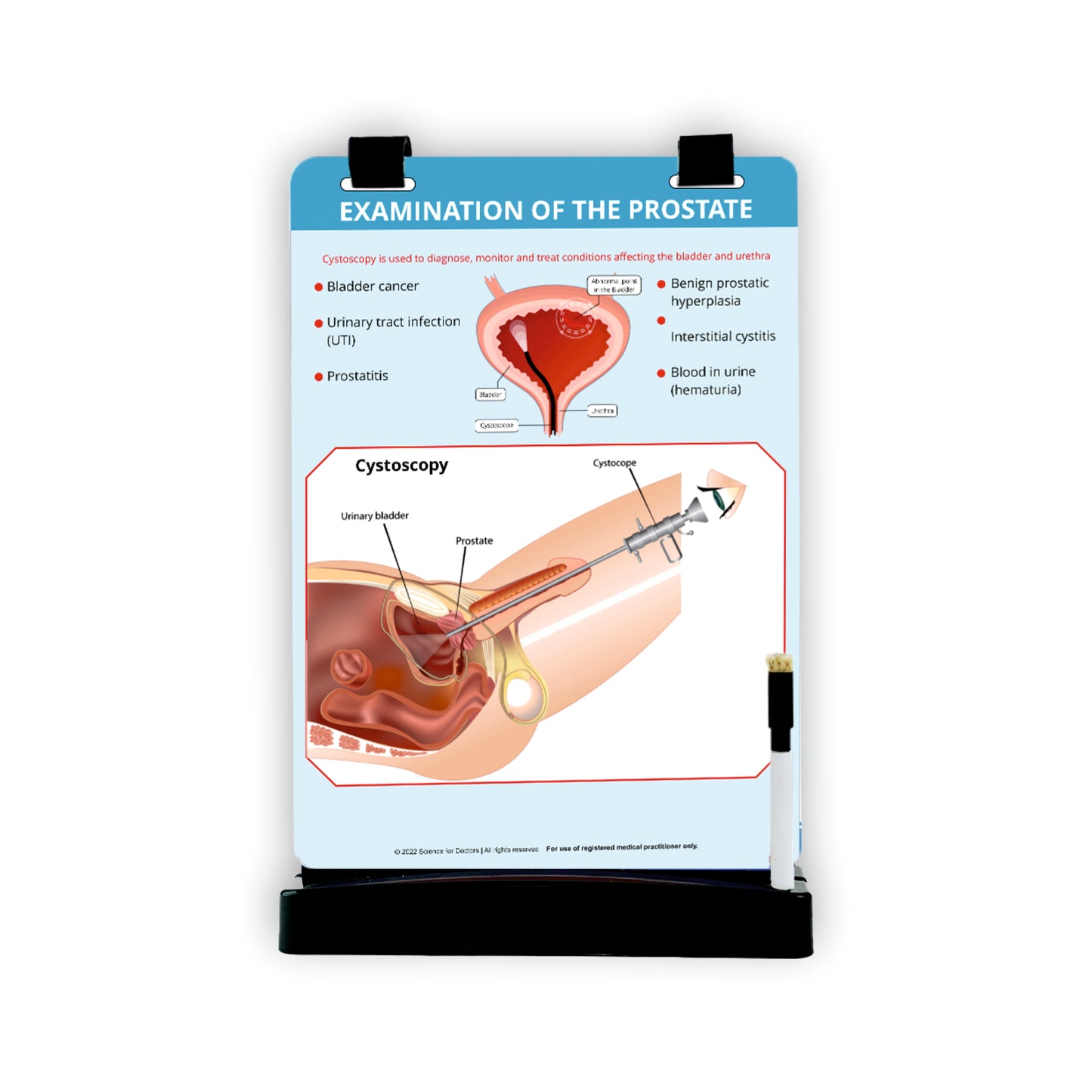Examination of The Prostate: A4 Flip Wipe