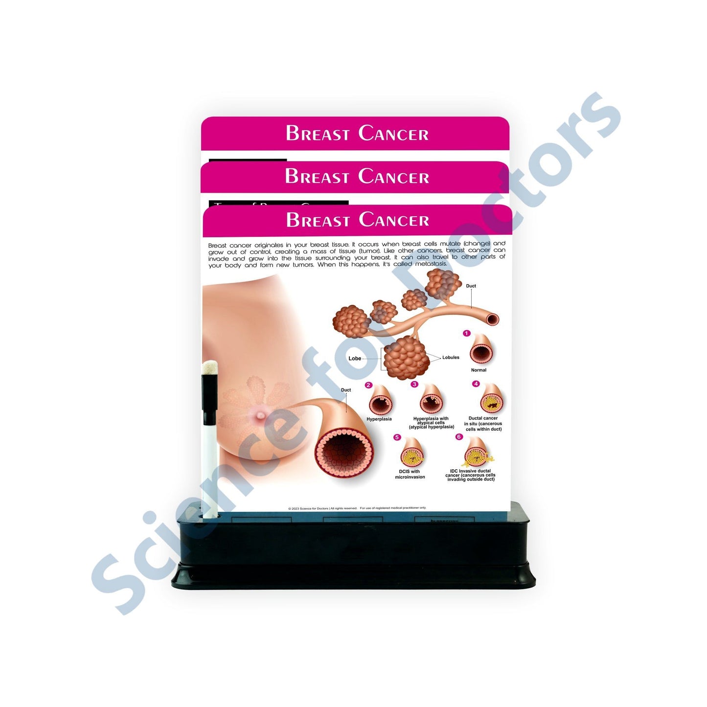 Breast Cancer: 3 slide on stand