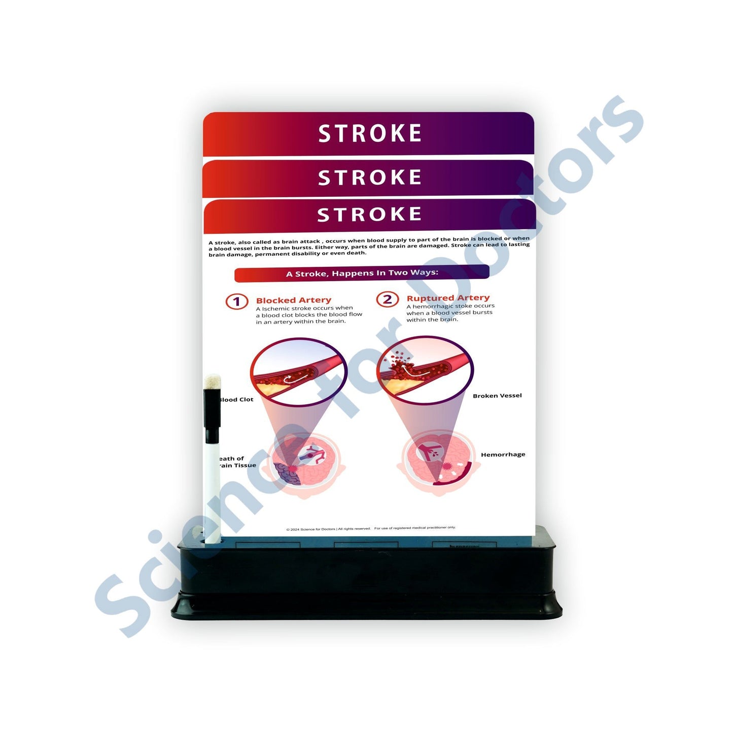 Stroke_1: 3 slide on stand