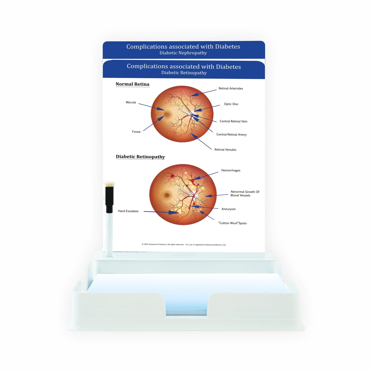 Complicated Associated With Diabetes: 2 Slides Patient Leaflet Tray