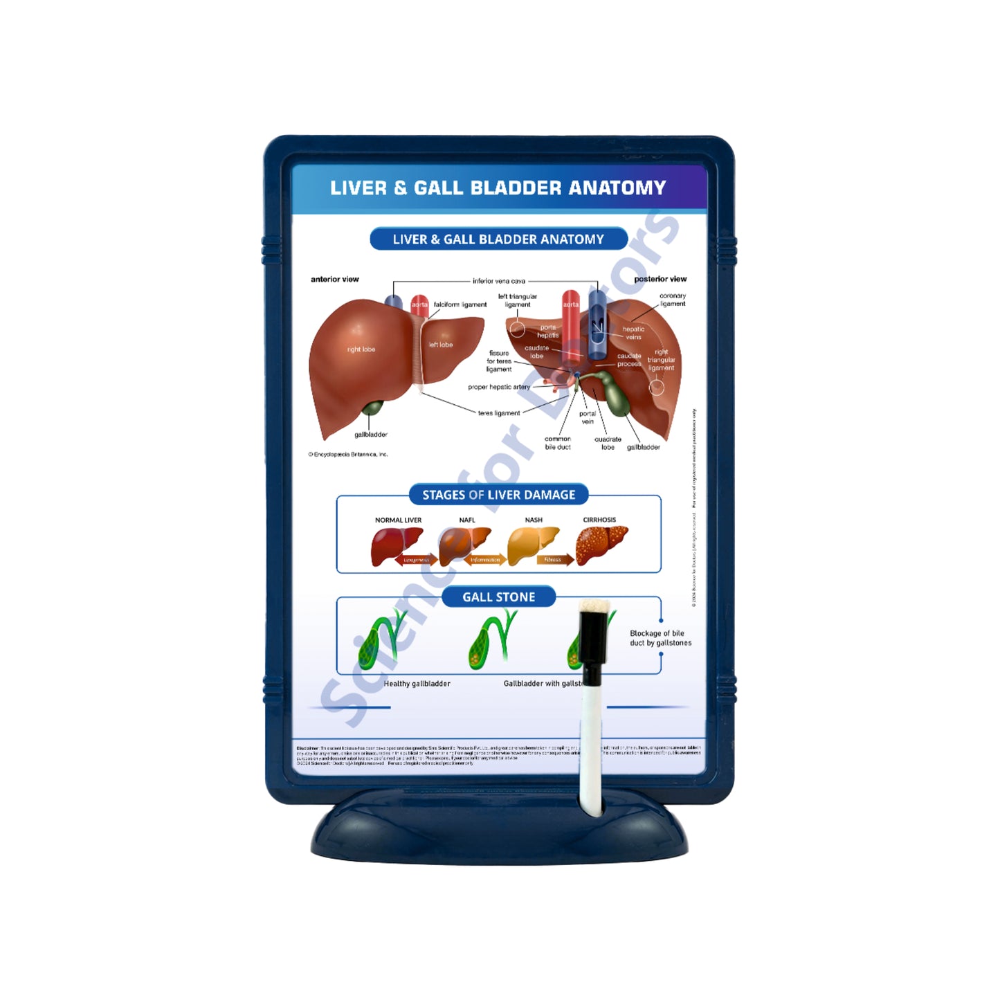 Liver & Gall Bladder Anatomy: The Frame Write & Wipe