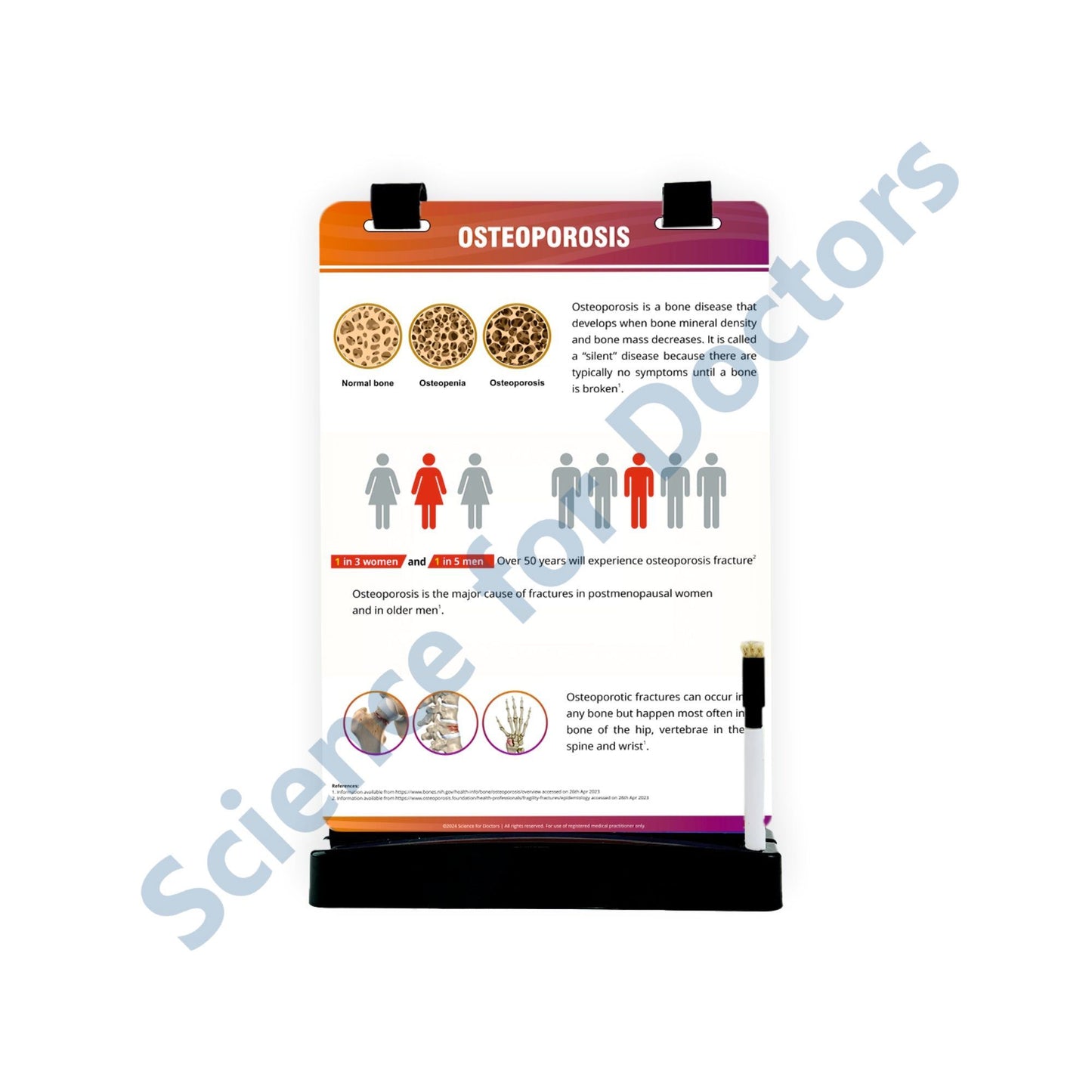 Osteoporosis_1: A4 Flip Wipe