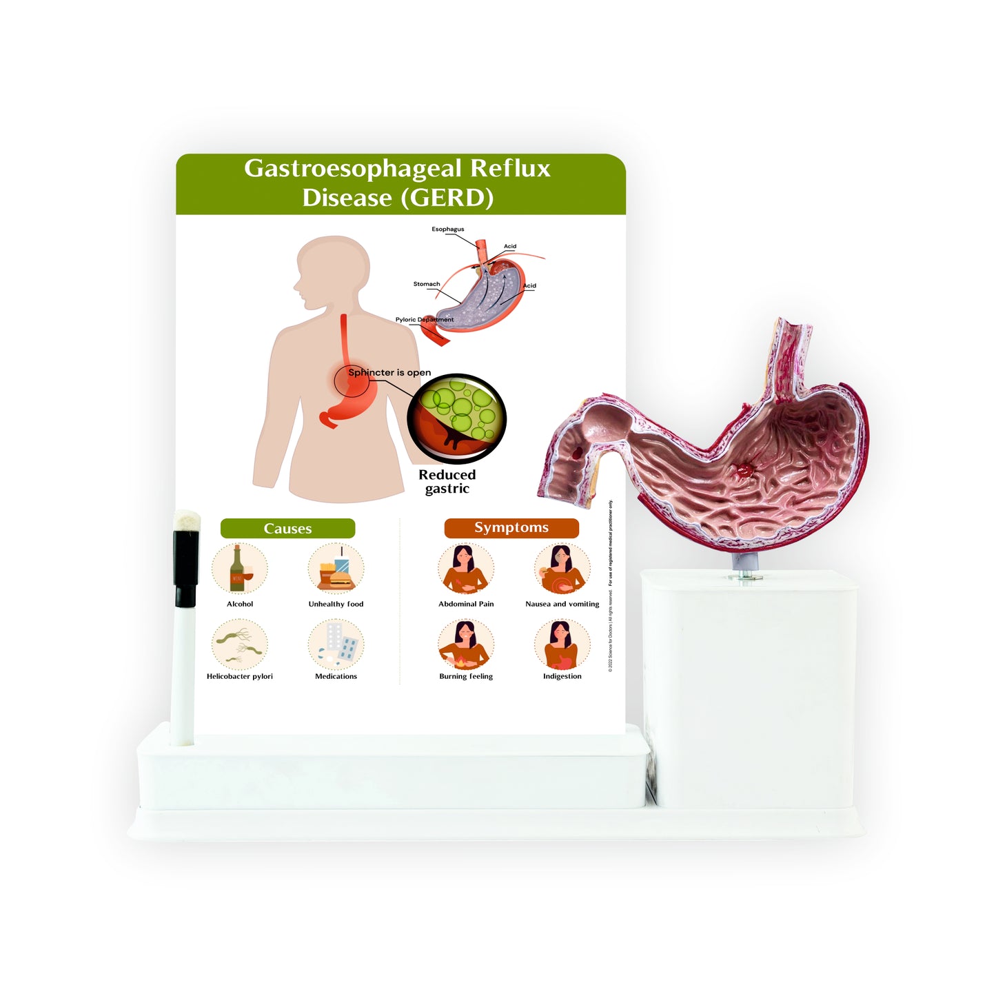 Gastroesophageal Reflux Disease_1: 1 Slide write and wipe with anatomical model on stand
