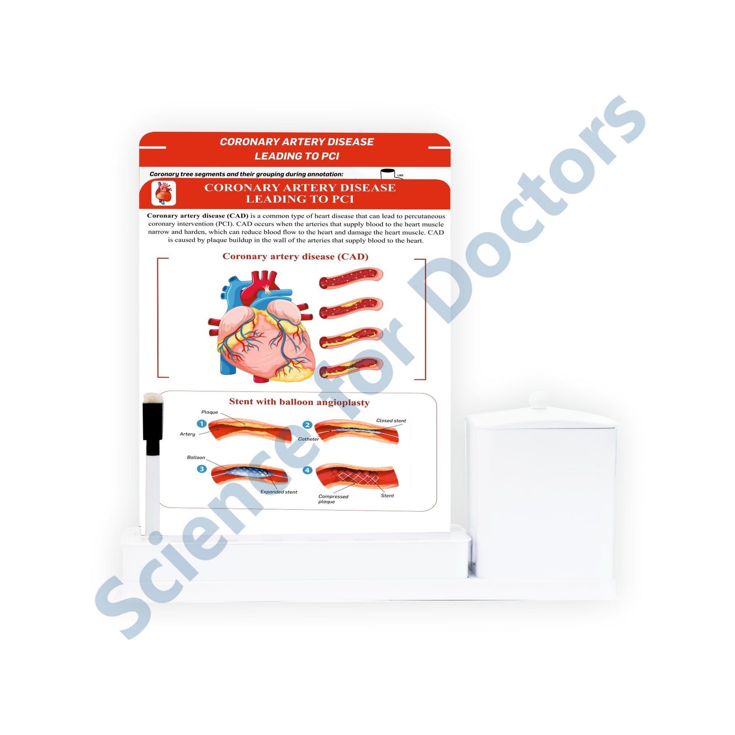Coronary Artery Disease Leading to PCI - 2 Slides Write and Wipe with Utility Container