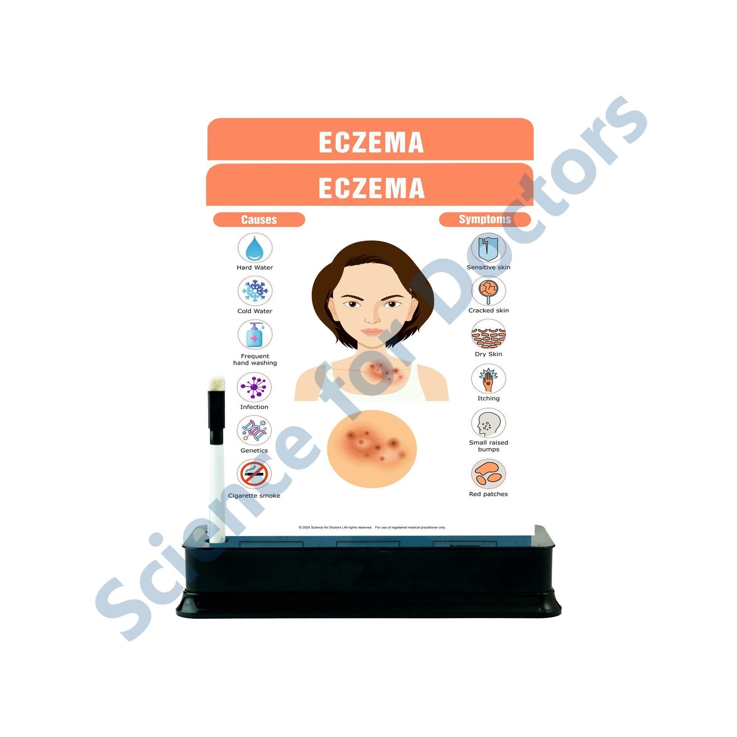 Eczema: 2 Slides on stand