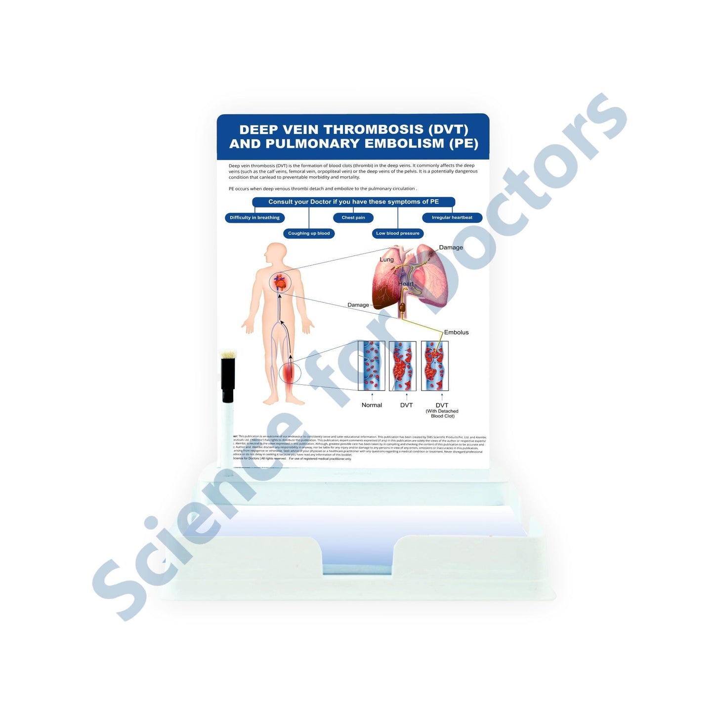 Deep Vein Thrombosis (DVT): 1 Slide with Patient Leaflet Tray
