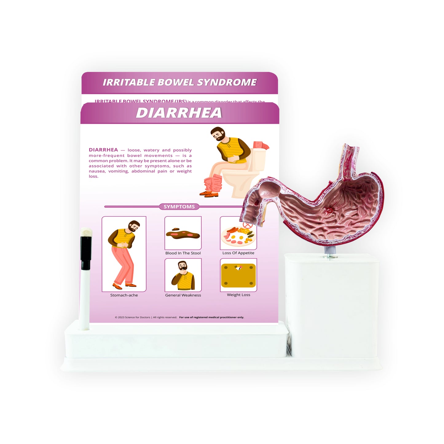 Diarrhea: 2 Slides Write and Wipe with Model On Stand