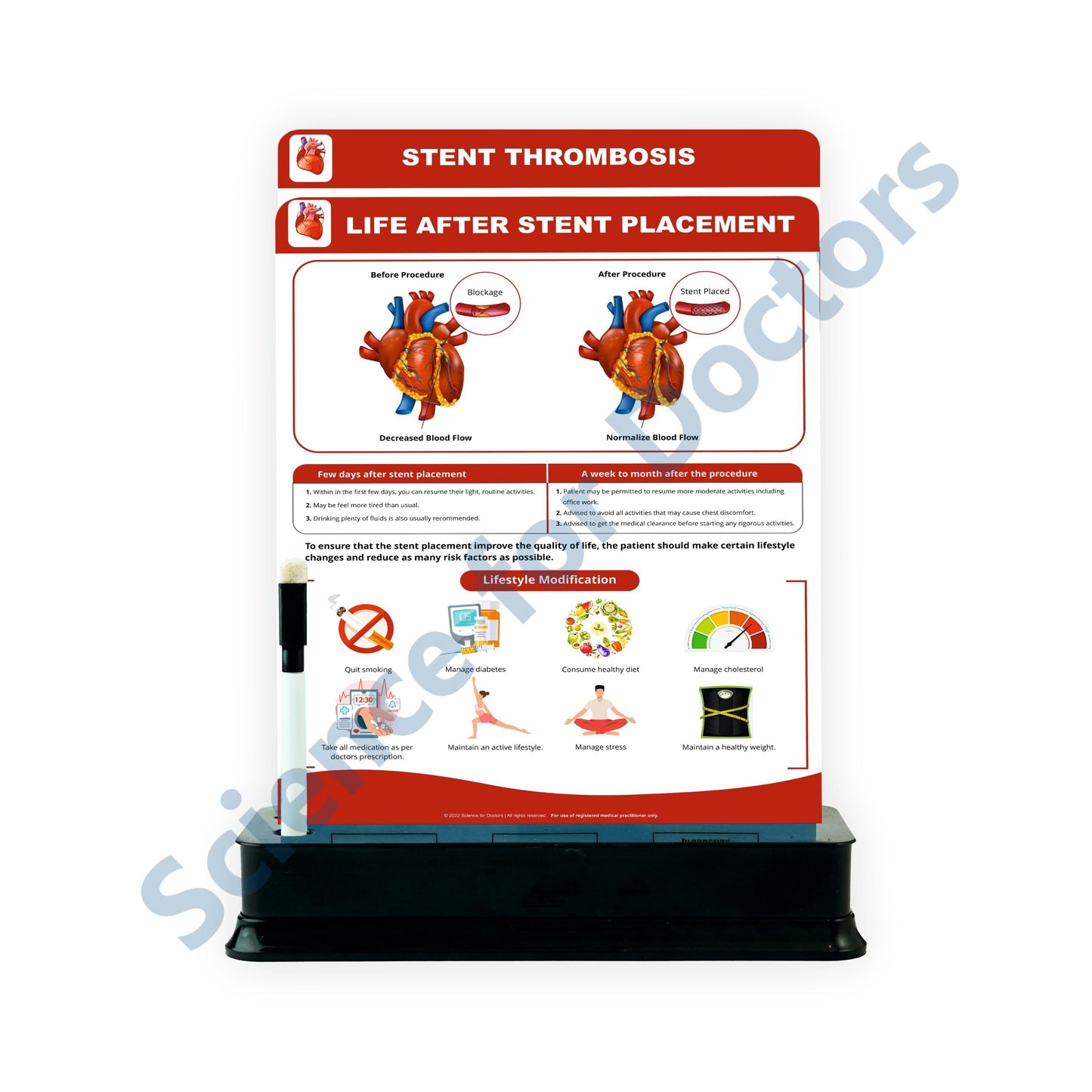 Life After Stent Placement: 2 slide on stand
