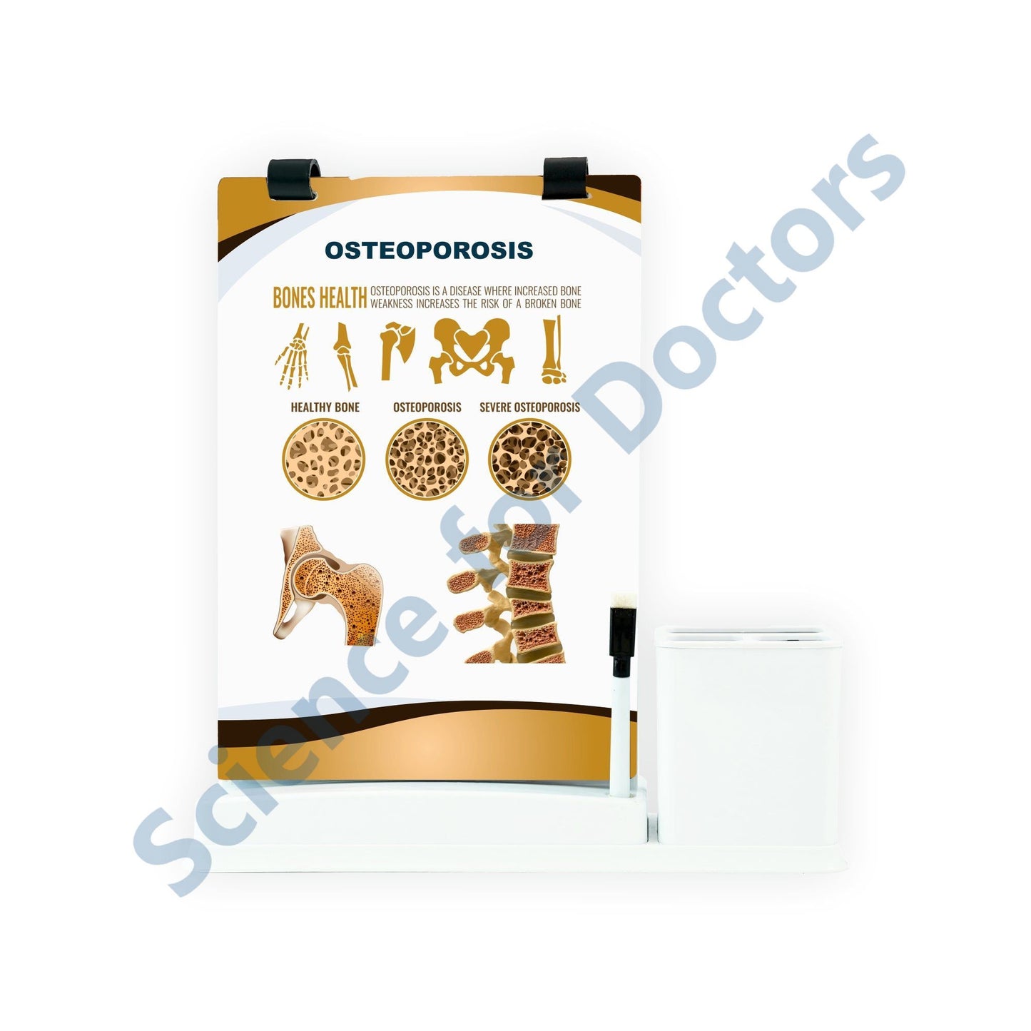Osteoporosis: A4 Flip Wipe With Stationary Stand