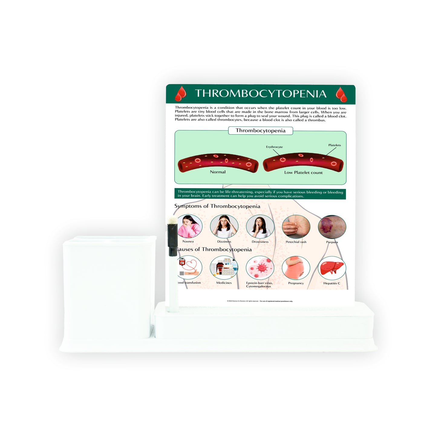 Thrombocytopenia: 1 Slide Write And Wipe With Stationary Stand