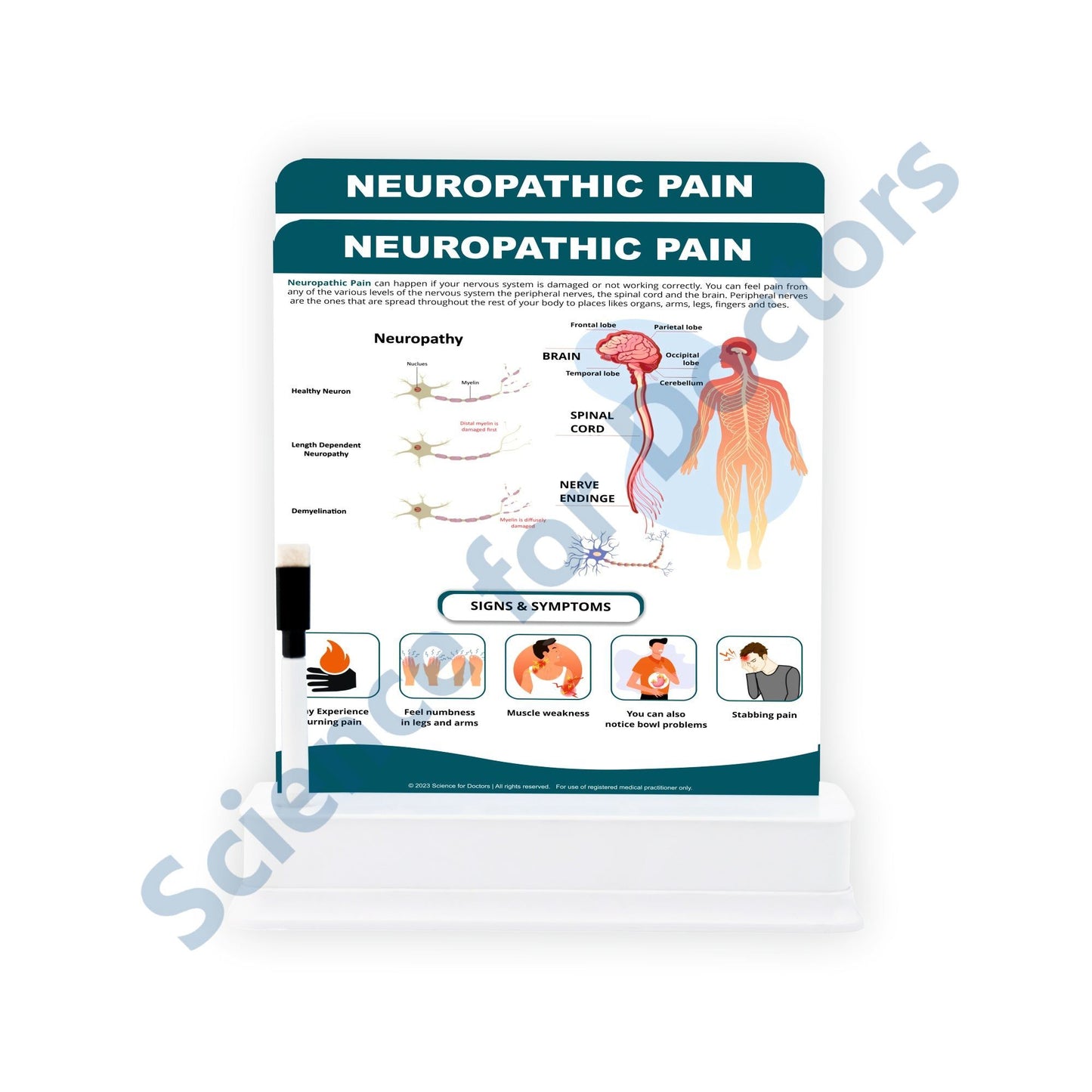 Neuropathic Pain: 2 Slides on stand