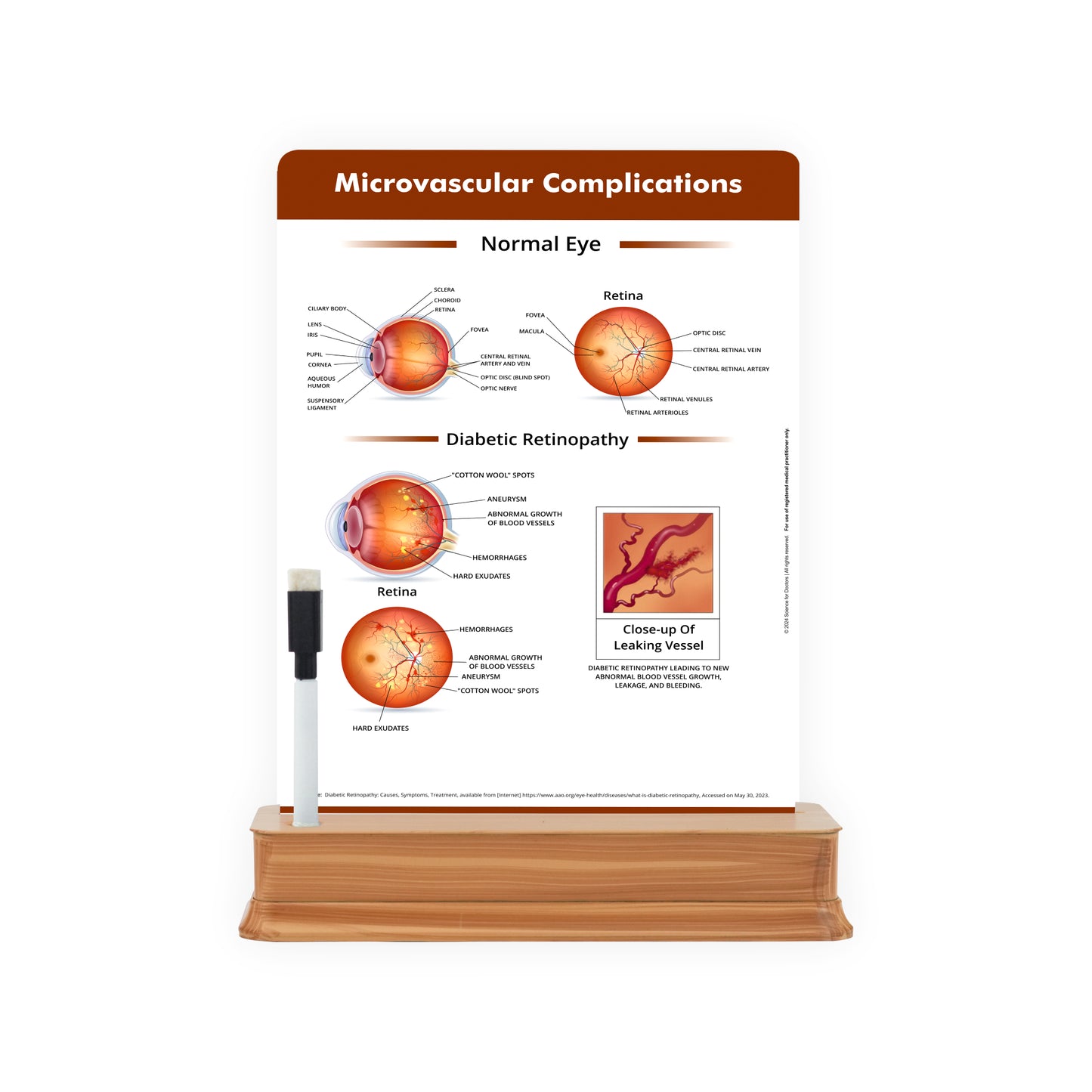 Microvascular Complications: 1 Slide on stand