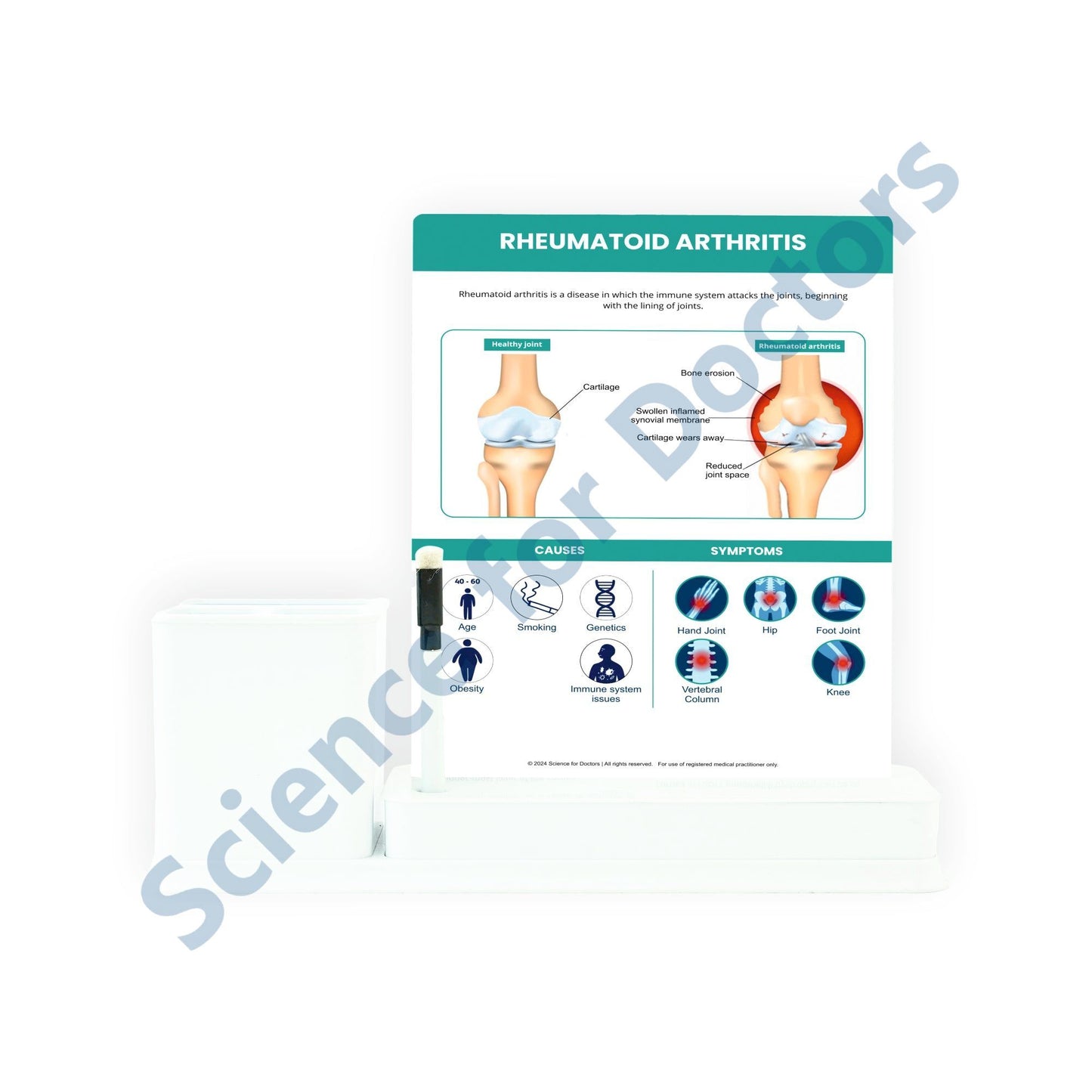 Rheumatoid Arthritis: 1 Slides Write & Wipe with Stationary Stand