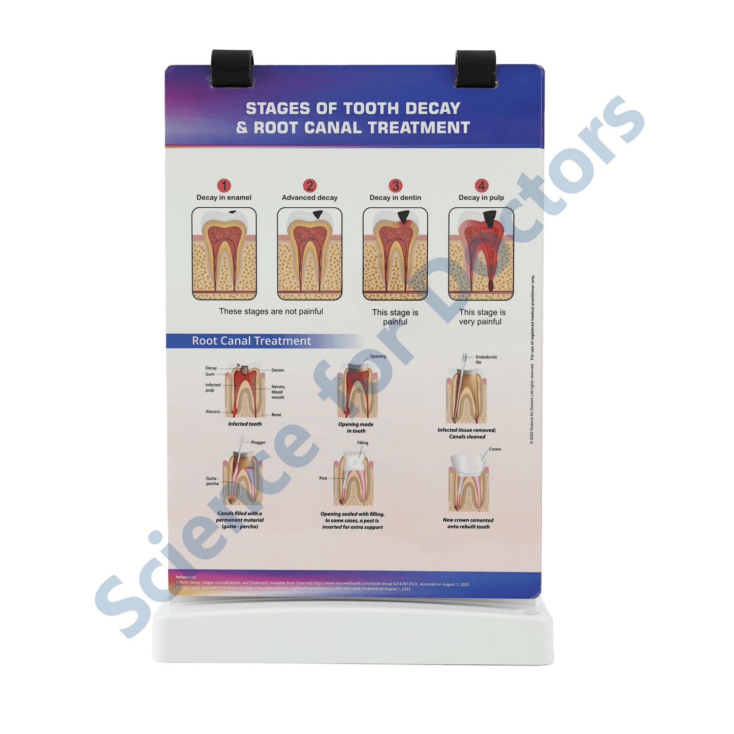 Stages of tooth decay & root canal treatment: A4 Flip Wipe