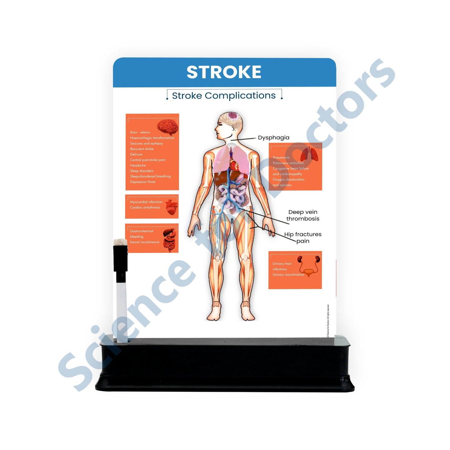 Stroke: 1 slide on stand