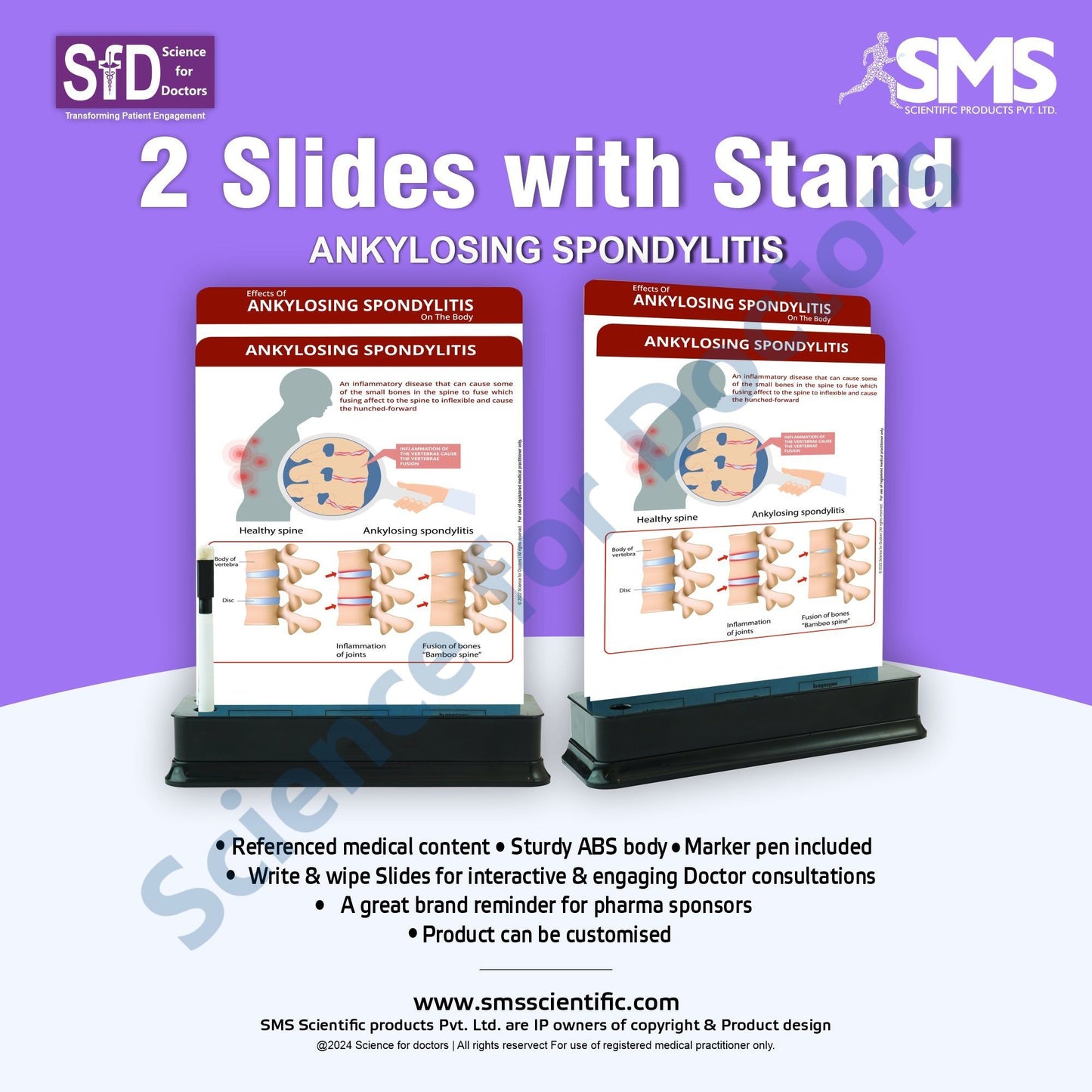 Ankylosing Spondylitis: 2 Slides on stand