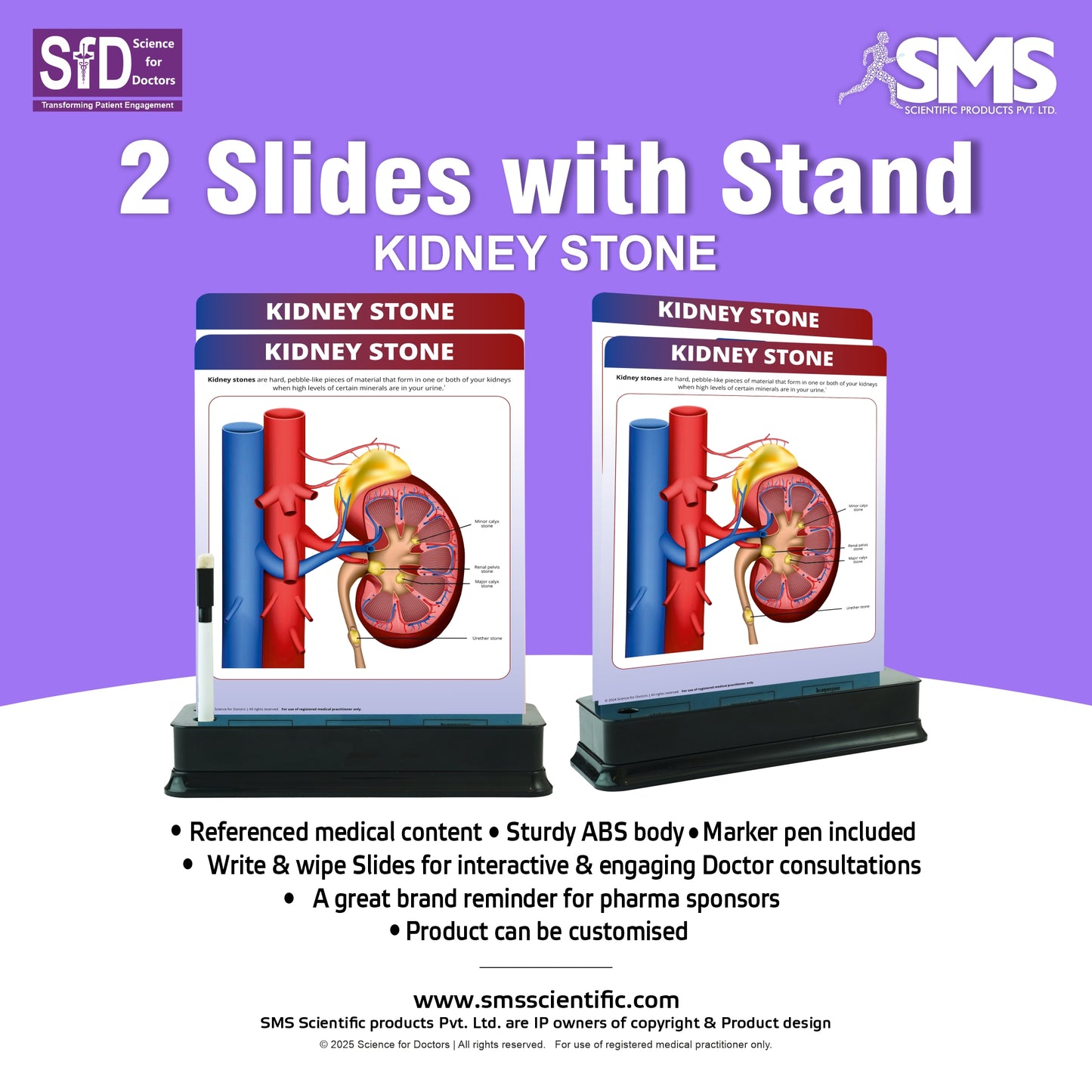 Kidney Stone : 2 Slides With Stand